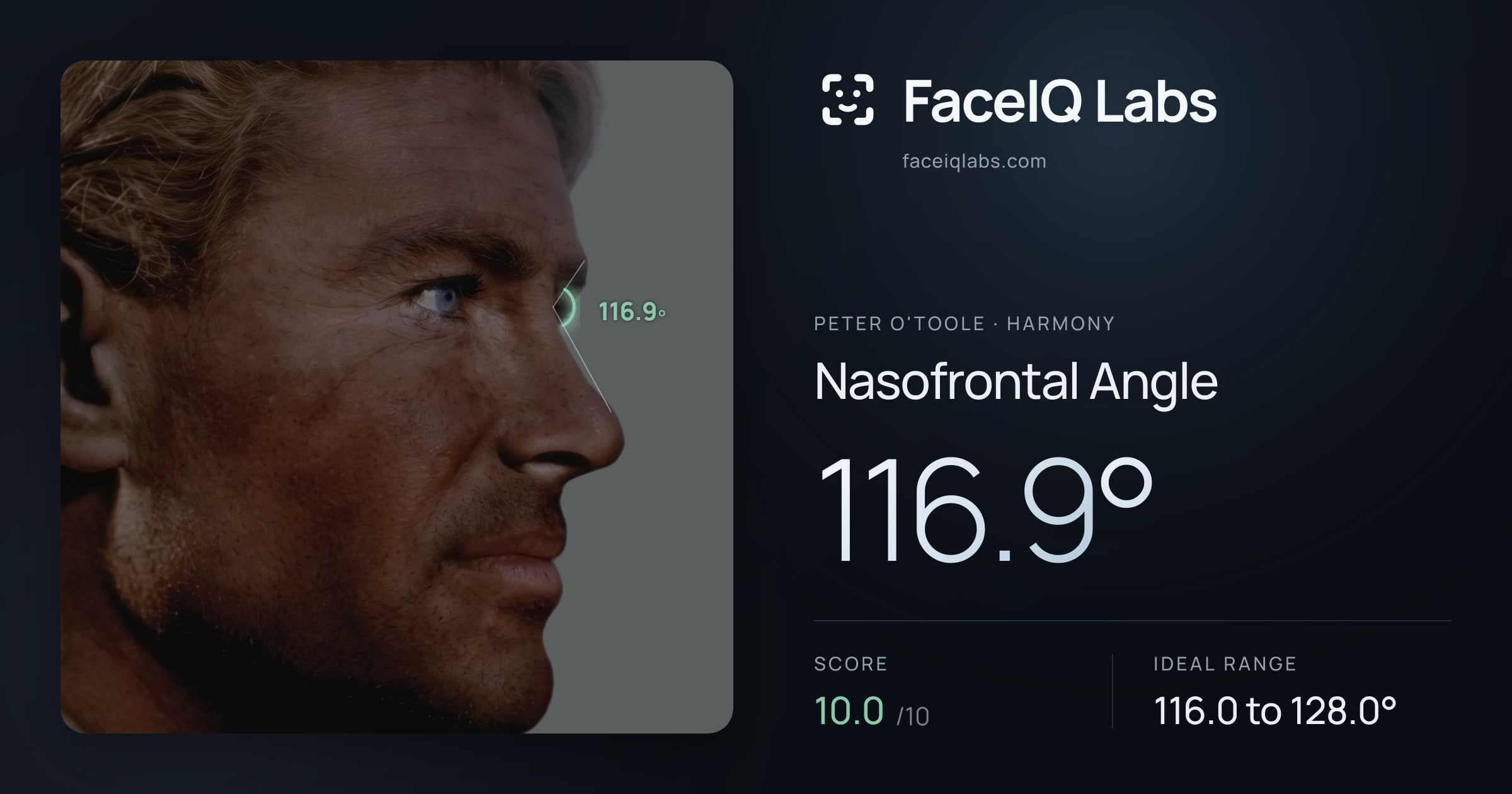 Peter O'Toole Nasofrontal Angle: 116.9°, drawn on the photo