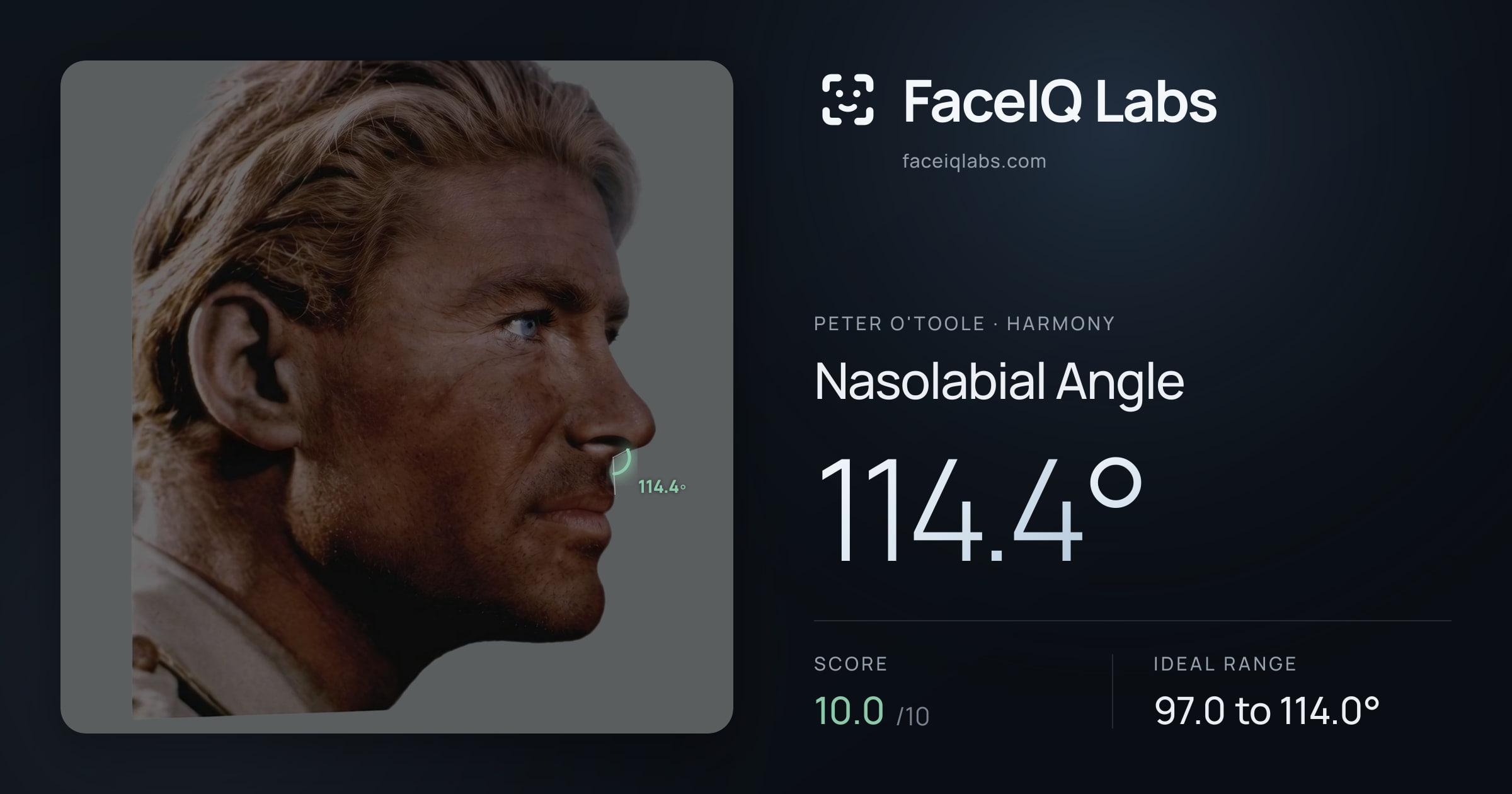Peter O'Toole Nasolabial Angle: 114.4°, drawn on the photo