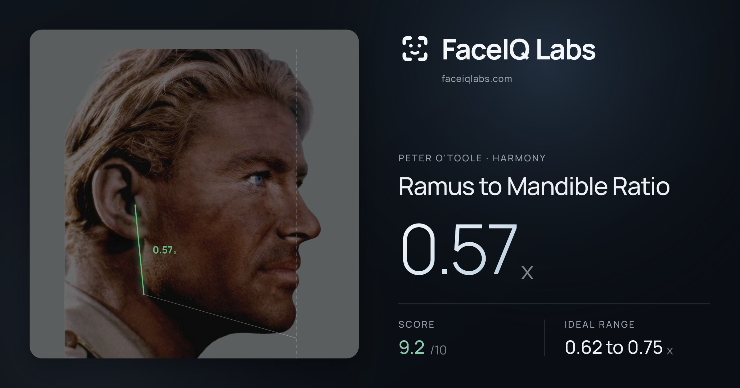 Peter O'Toole Ramus to Mandible Ratio: 0.57x, drawn on the photo