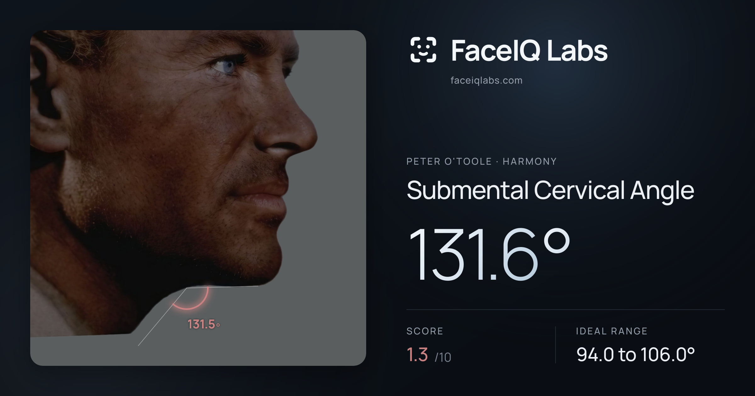 Peter O'Toole Submental Cervical Angle: 131.6°, drawn on the photo
