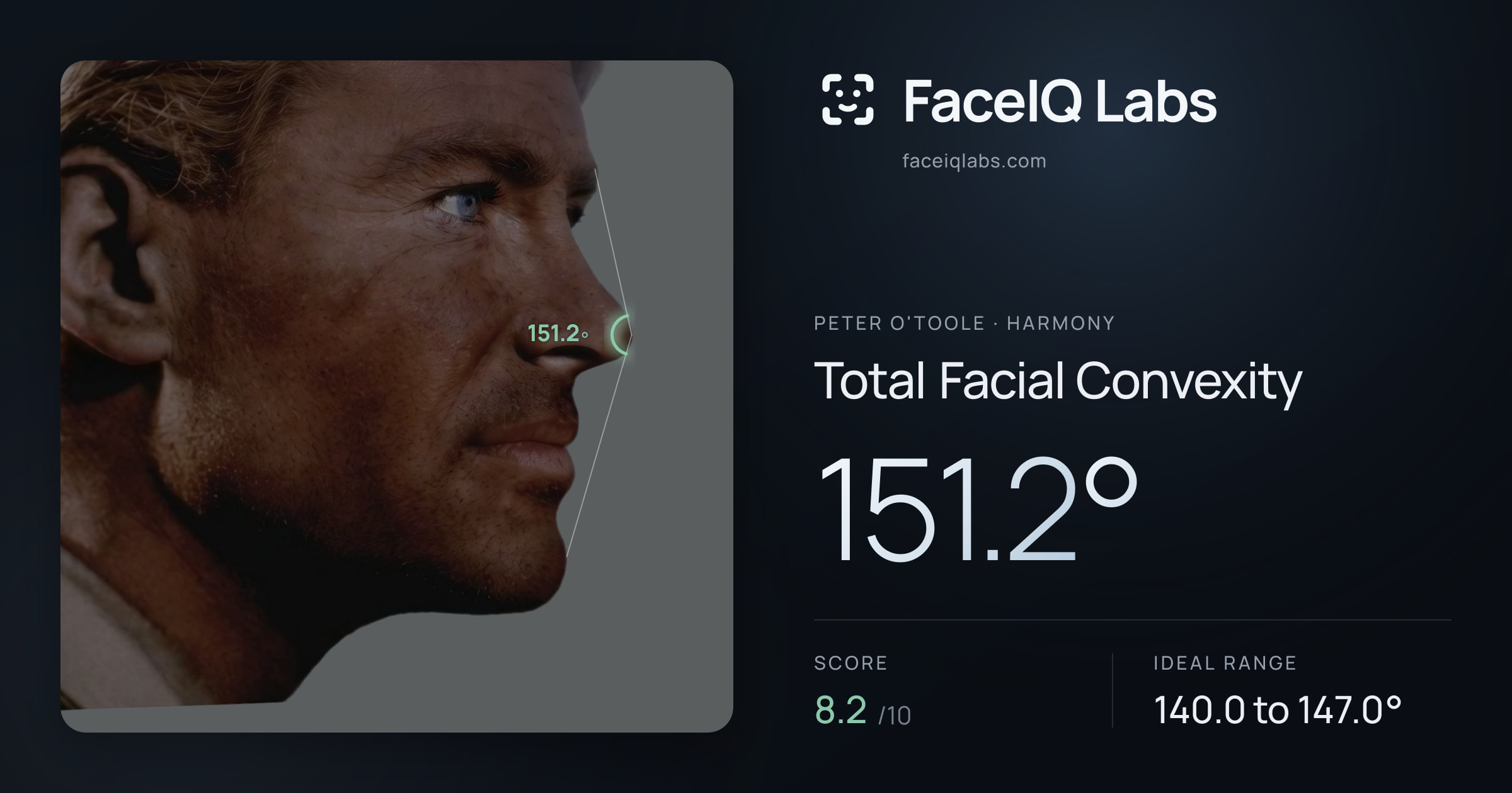 Peter O'Toole Total Facial Convexity: 151.2°, drawn on the photo