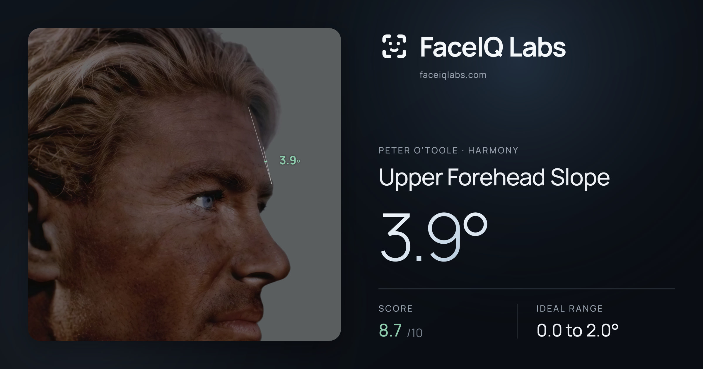 Peter O'Toole Upper Forehead Slope: 3.9°, drawn on the photo