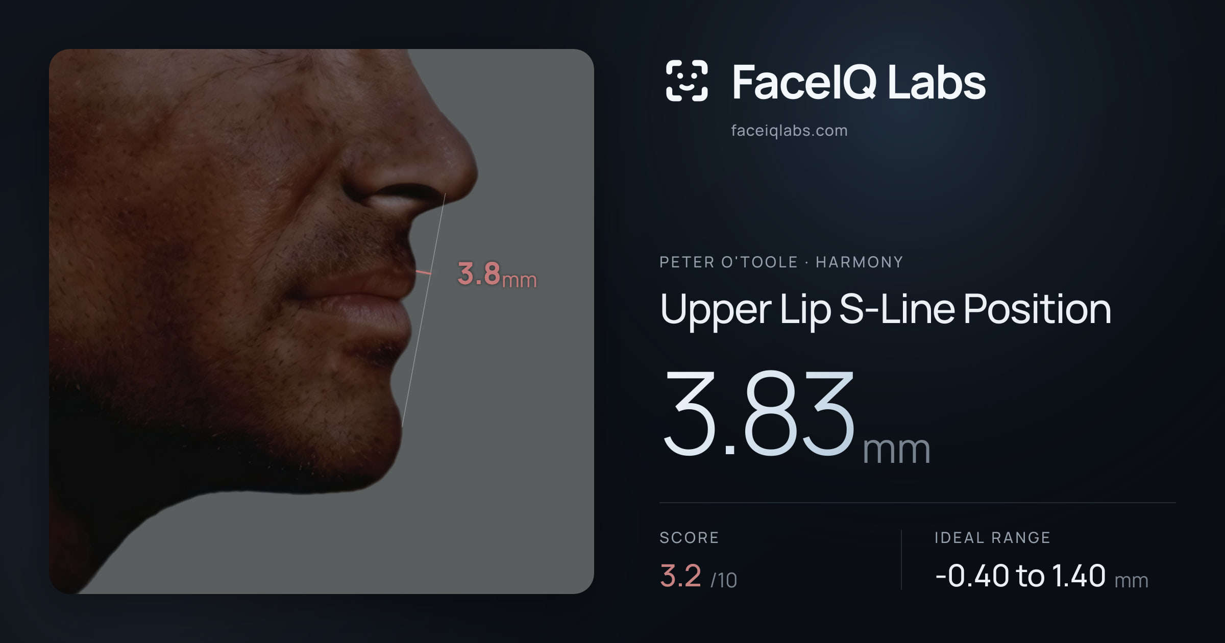 Peter O'Toole Upper Lip S-Line Position: 3.83mm, drawn on the photo