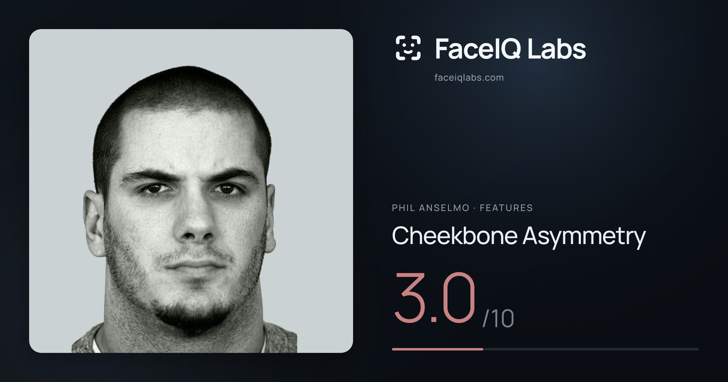 Phil Anselmo Cheekbone Asymmetry: 3.0/10, drawn on the photo