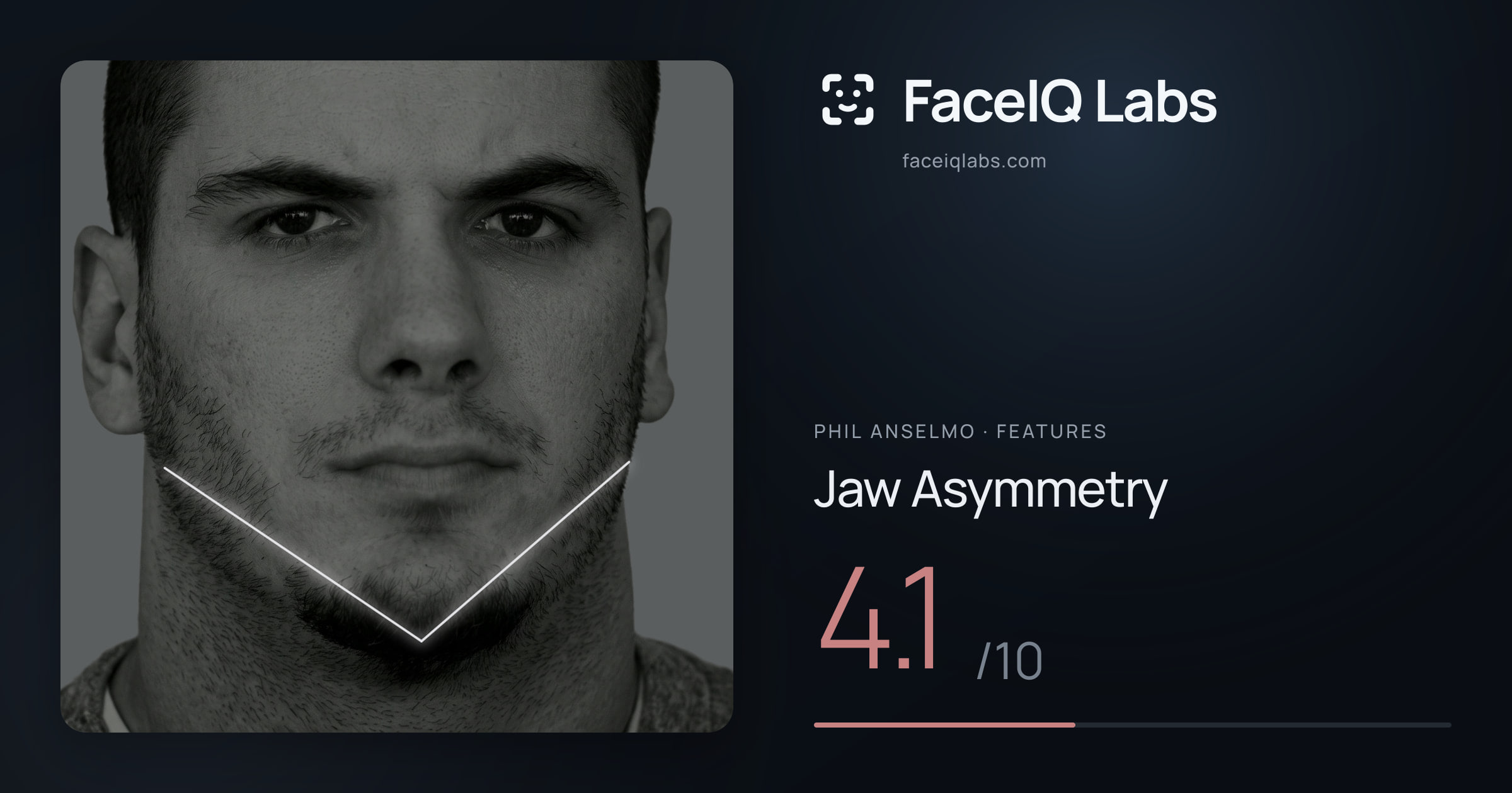 Phil Anselmo Jaw Asymmetry: 4.1/10, drawn on the photo
