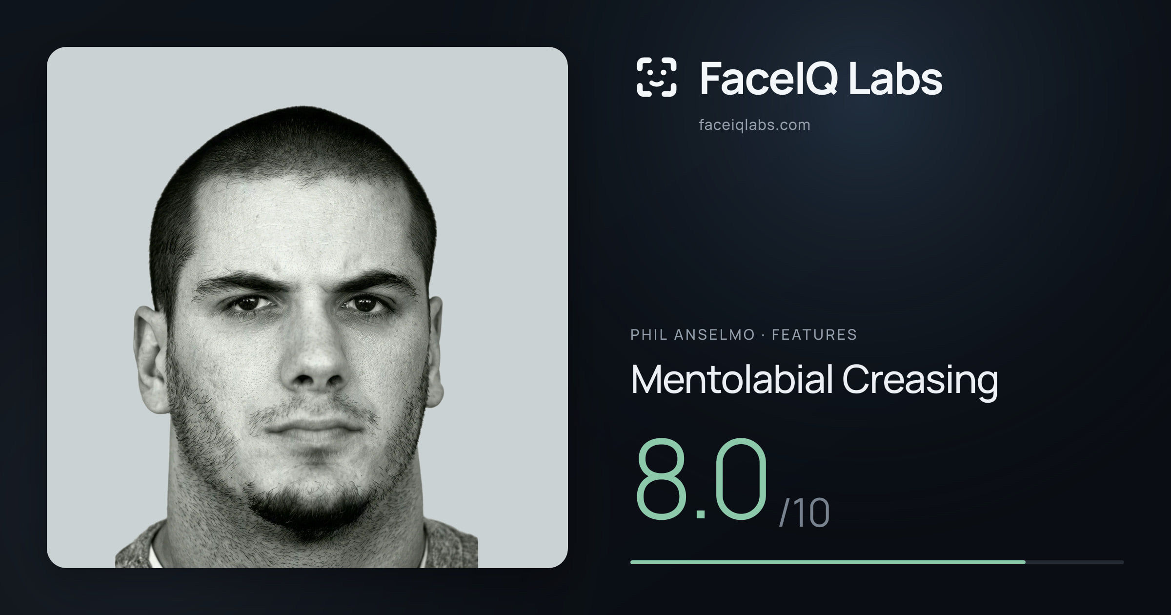 Phil Anselmo Mentolabial Creasing: 8.0/10, drawn on the photo