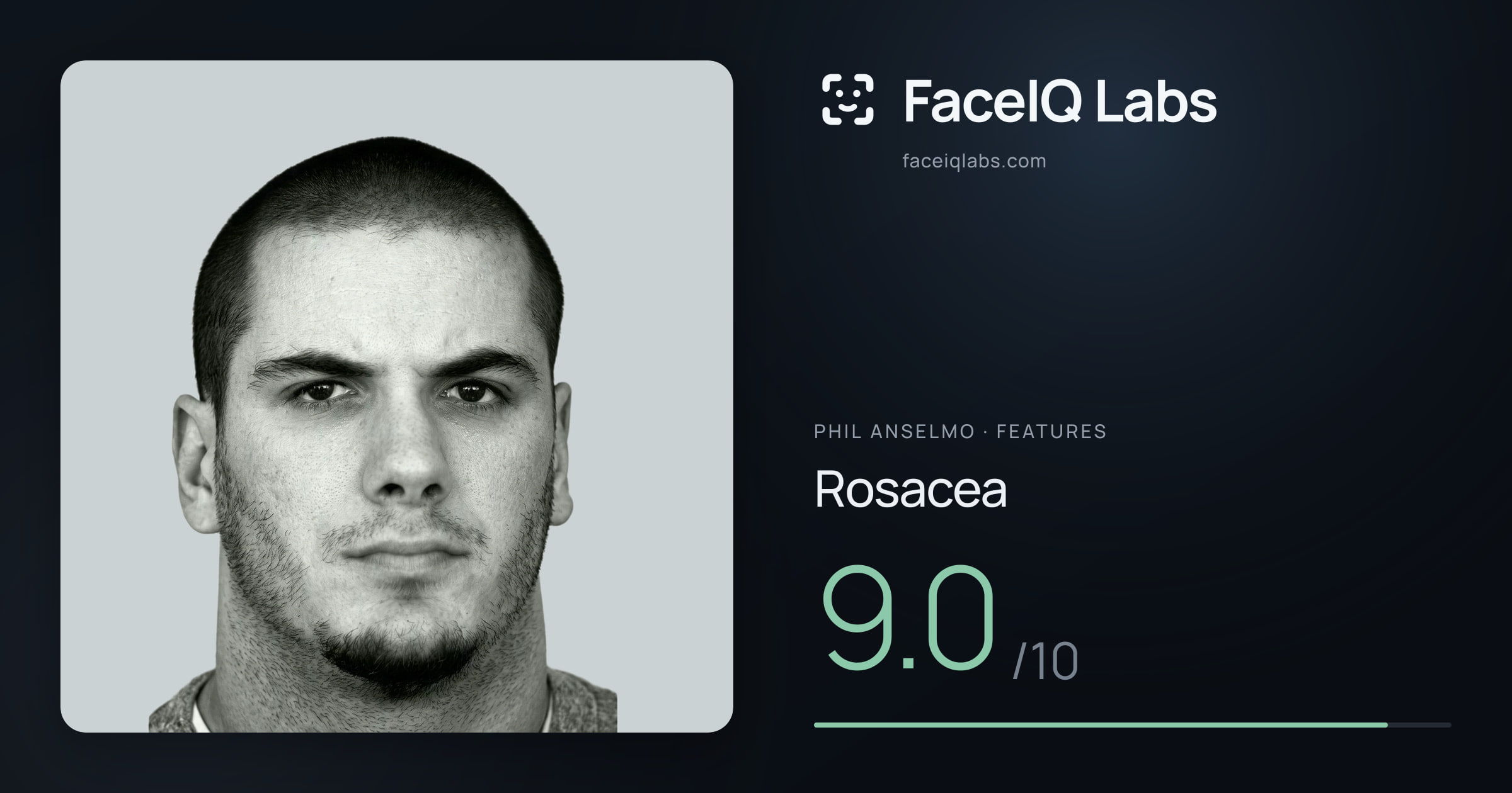 Phil Anselmo Rosacea: 9.0/10, drawn on the photo