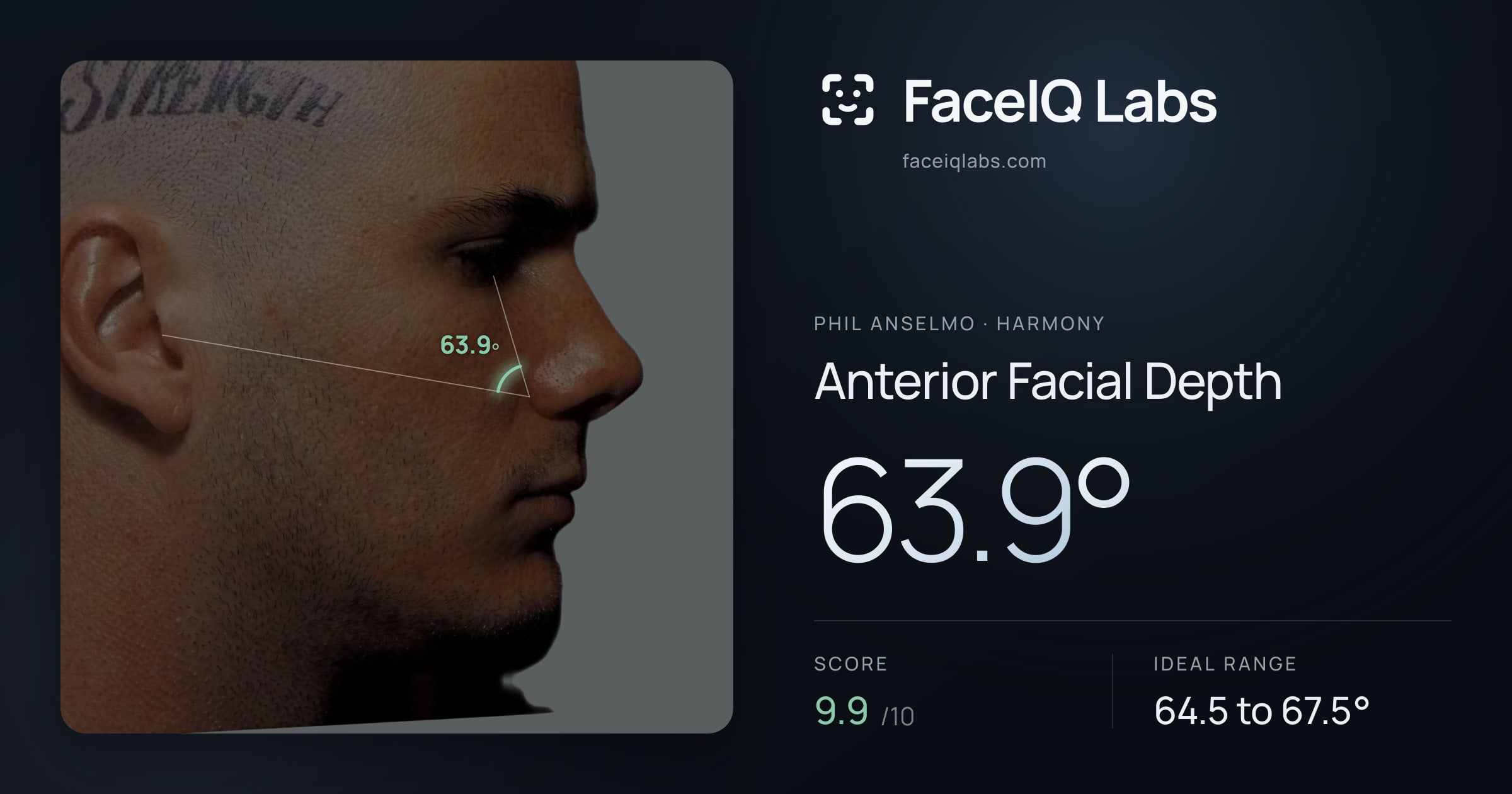 Phil Anselmo Anterior Facial Depth: 63.9°, drawn on the photo