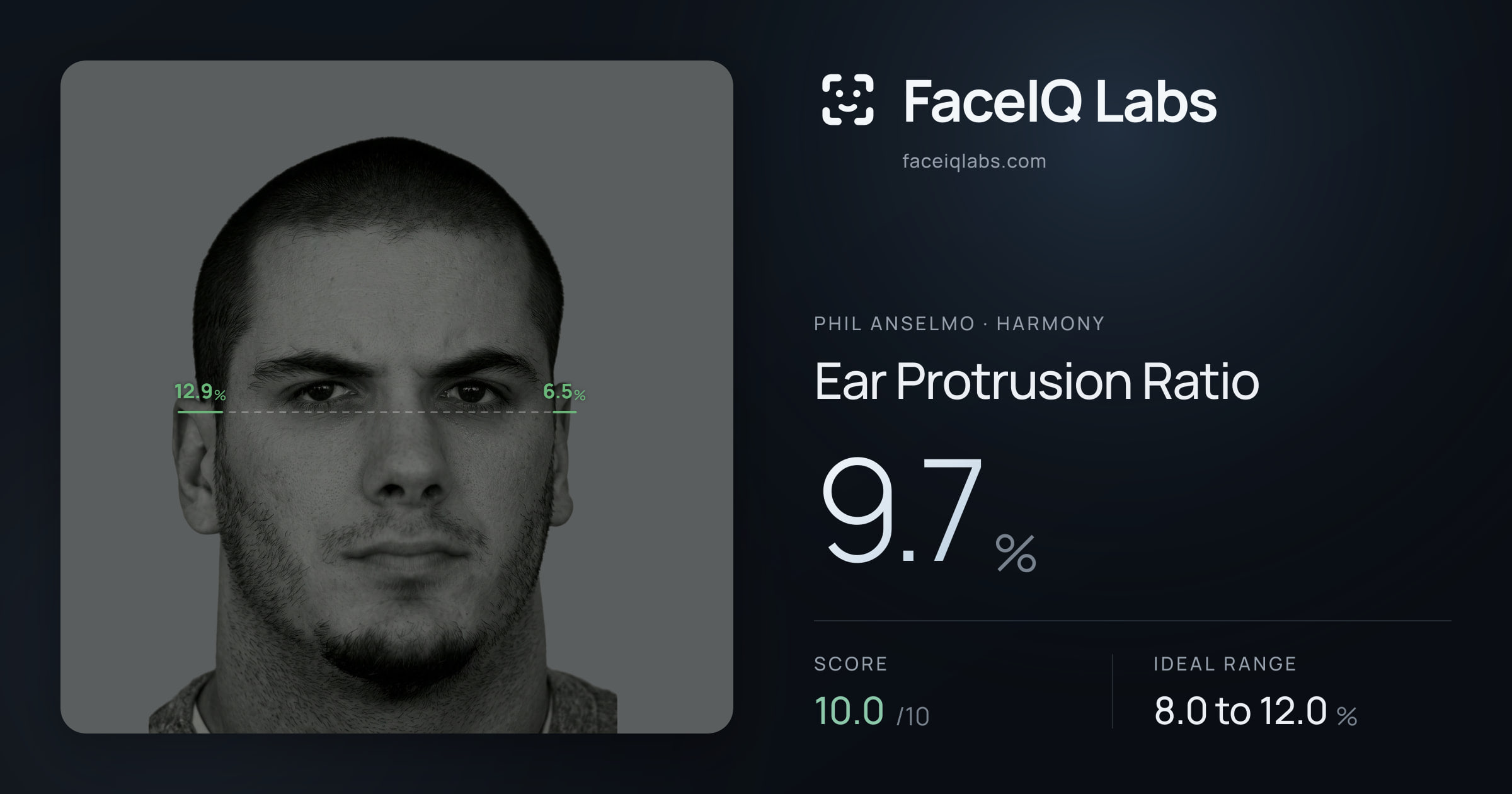 Phil Anselmo Ear Protrusion Ratio: 9.7%, drawn on the photo
