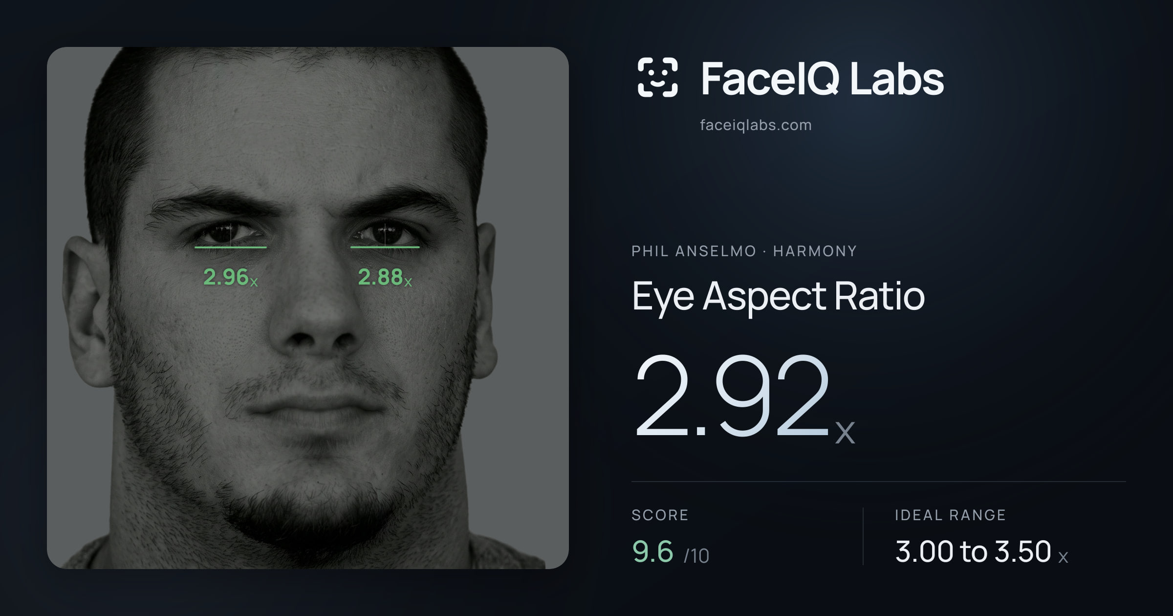 Phil Anselmo Eye Aspect Ratio: 2.92x, drawn on the photo