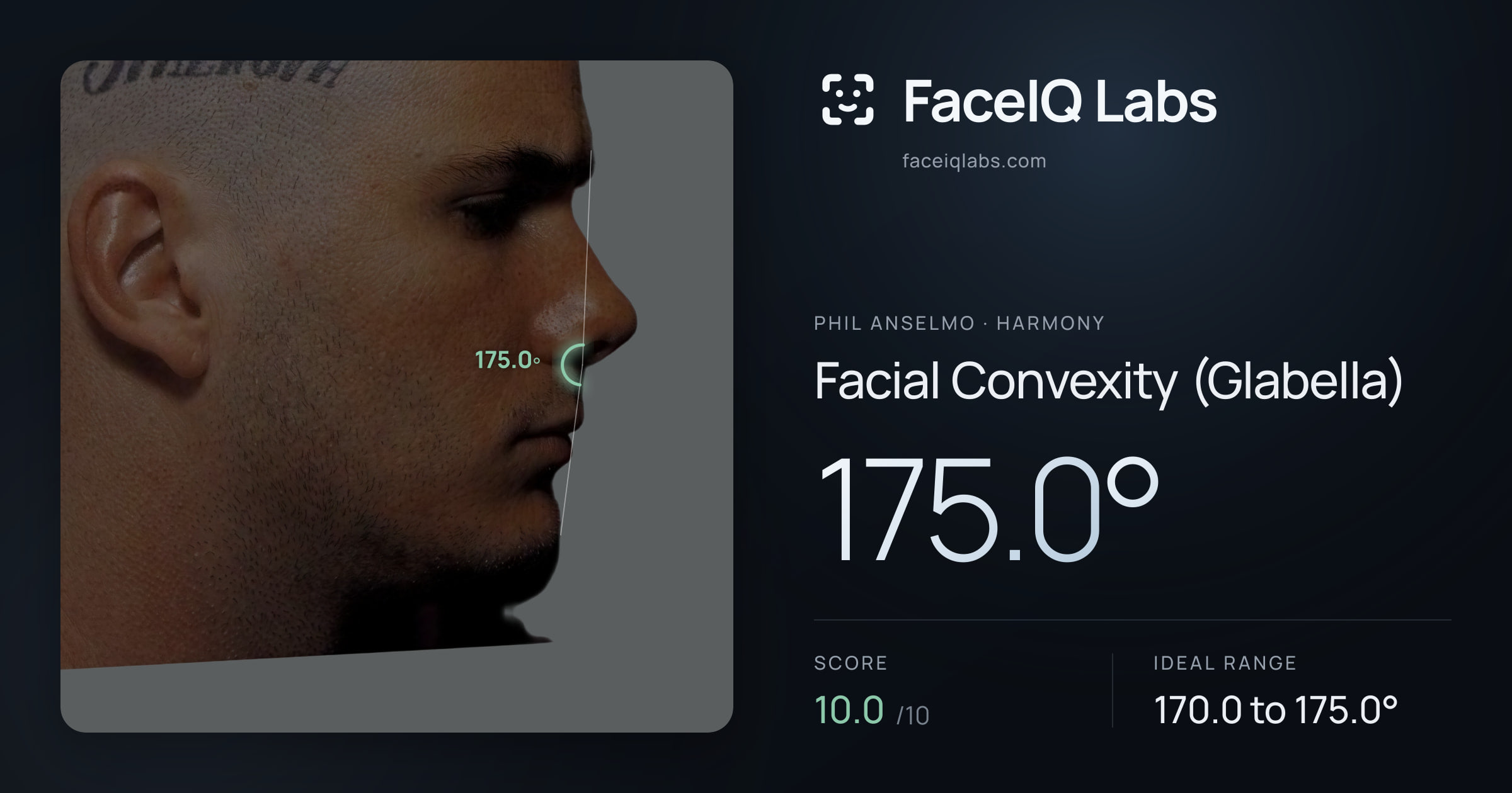 Phil Anselmo Facial Convexity (Glabella): 175.0°, drawn on the photo