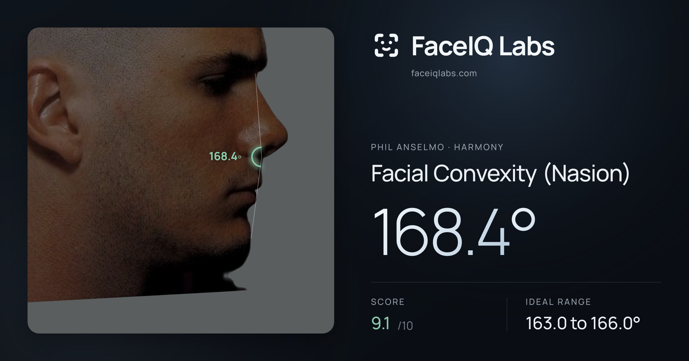 Phil Anselmo Facial Convexity (Nasion): 168.4°, drawn on the photo