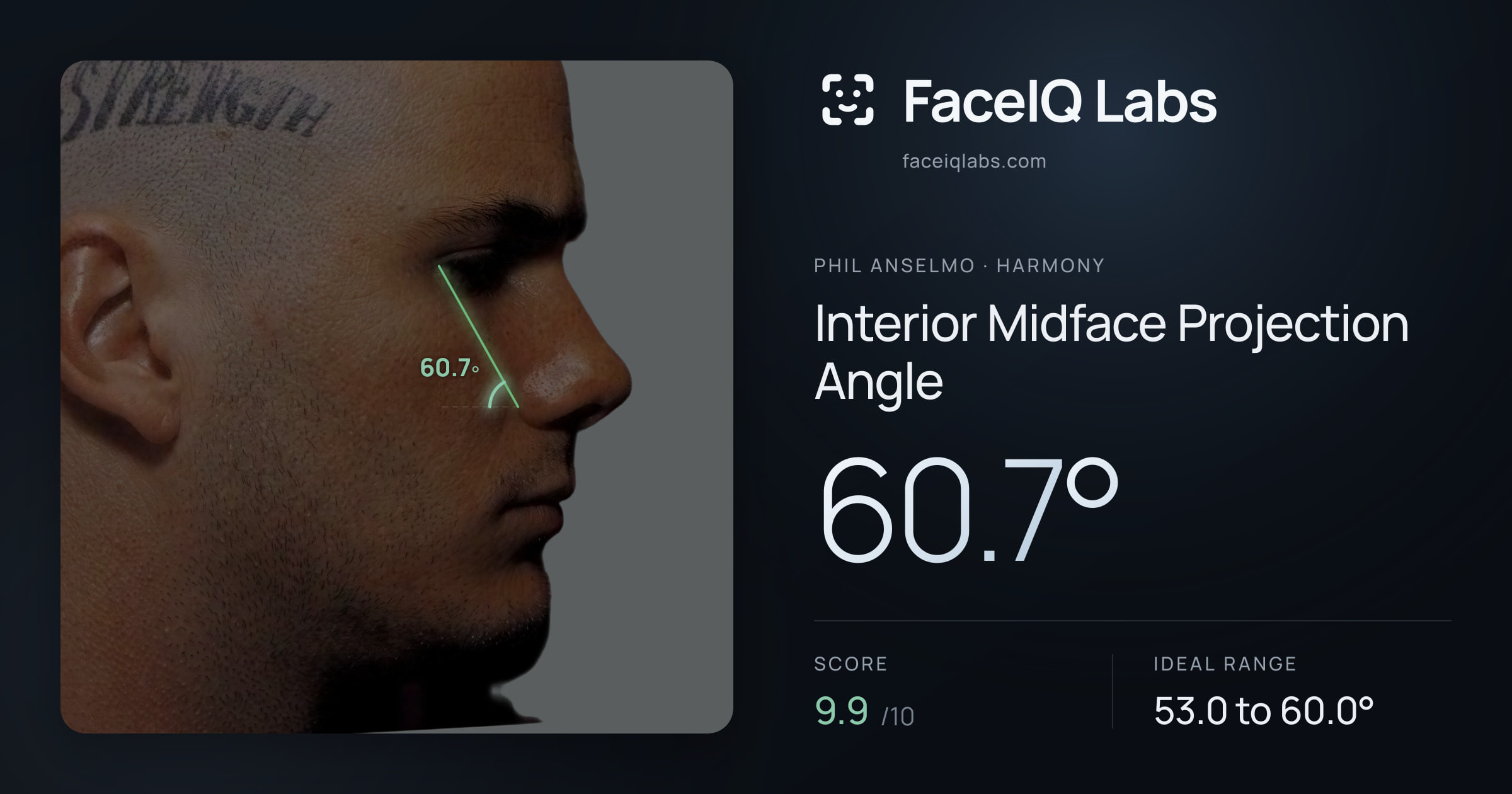 Phil Anselmo Interior Midface Projection Angle: 60.7°, drawn on the photo