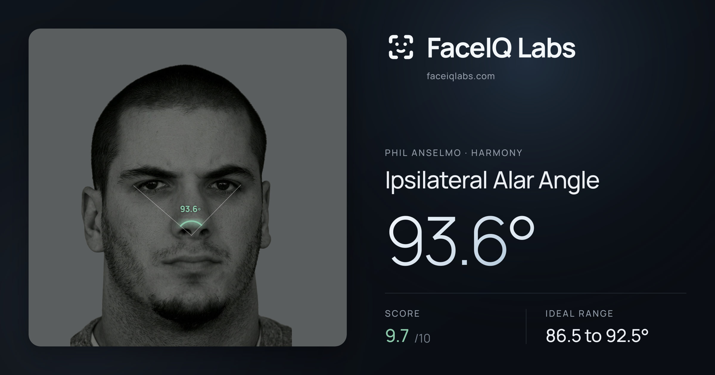 Phil Anselmo Ipsilateral Alar Angle: 93.6°, drawn on the photo