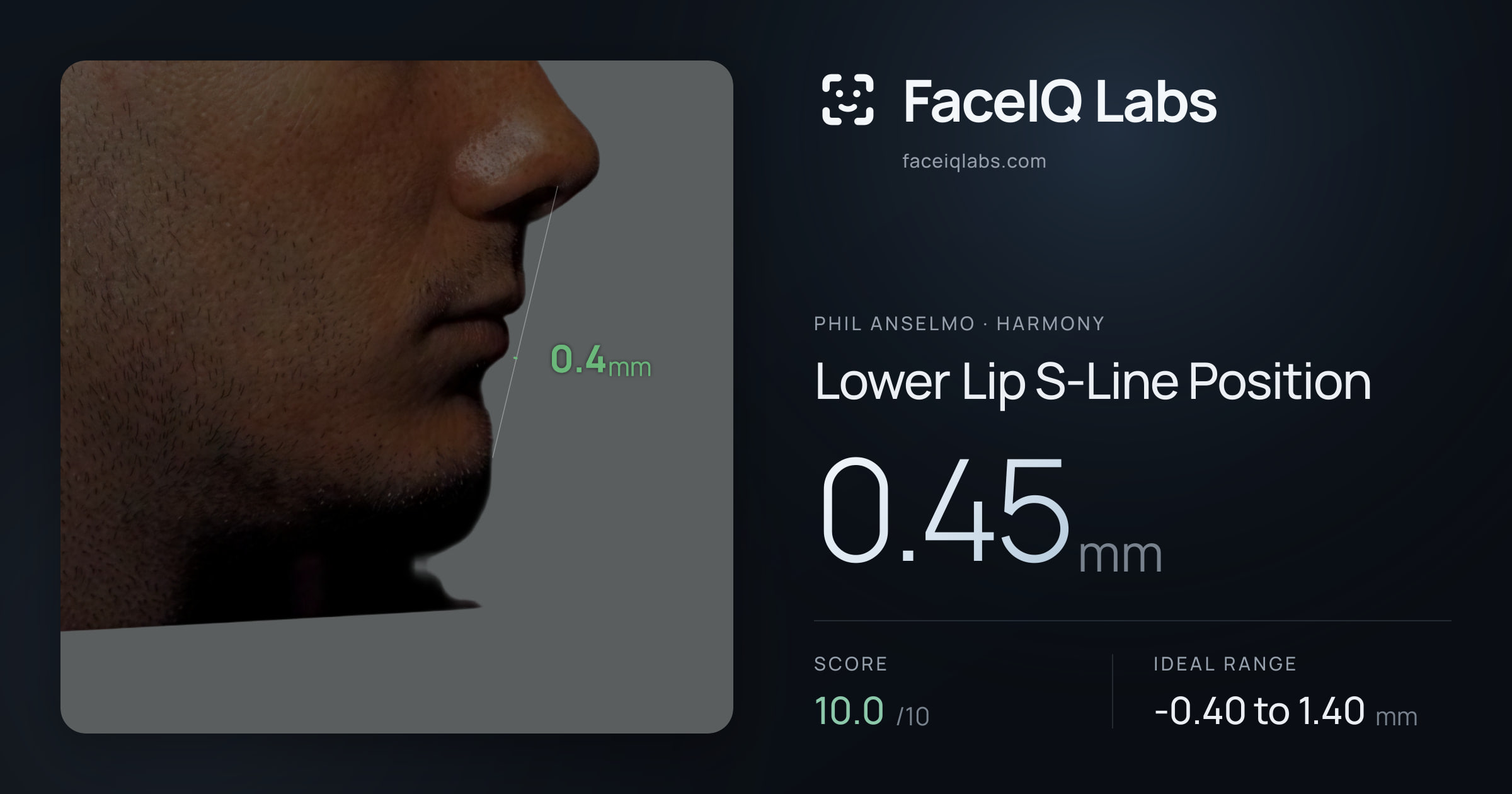 Phil Anselmo Lower Lip S-Line Position: 0.45mm, drawn on the photo