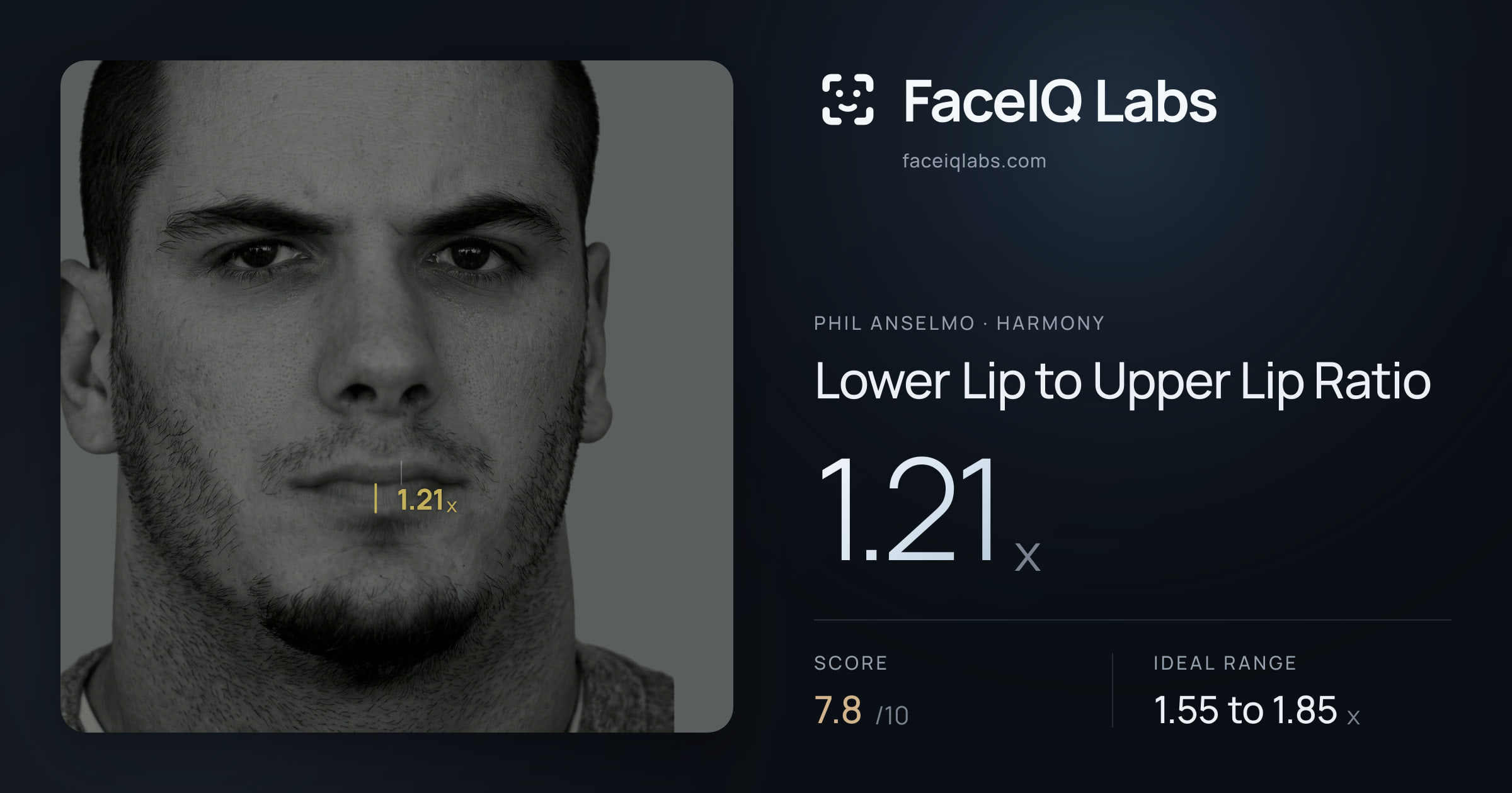 Phil Anselmo Lower Lip to Upper Lip Ratio: 1.21x, drawn on the photo