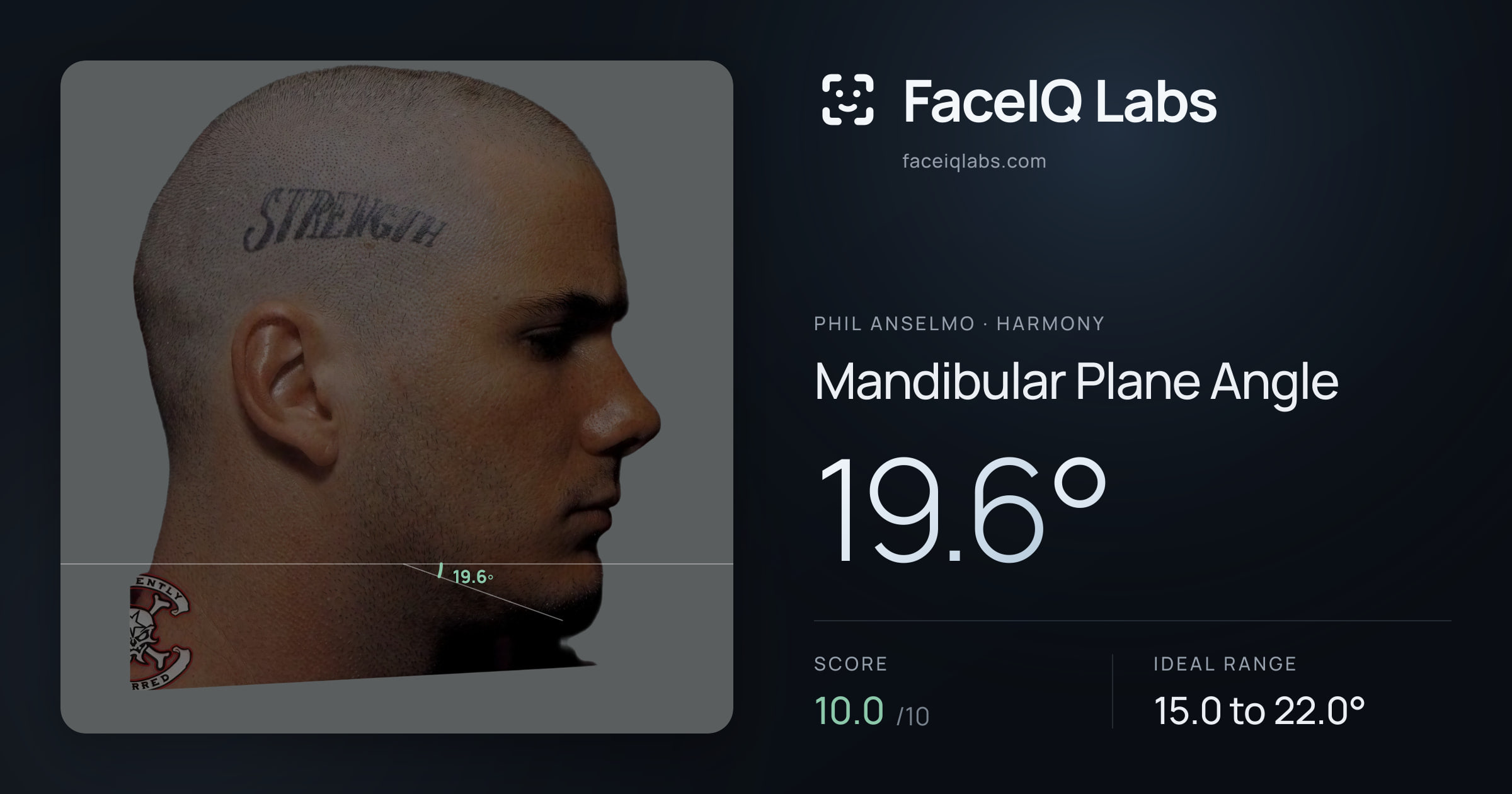 Phil Anselmo Mandibular Plane Angle: 19.6°, drawn on the photo