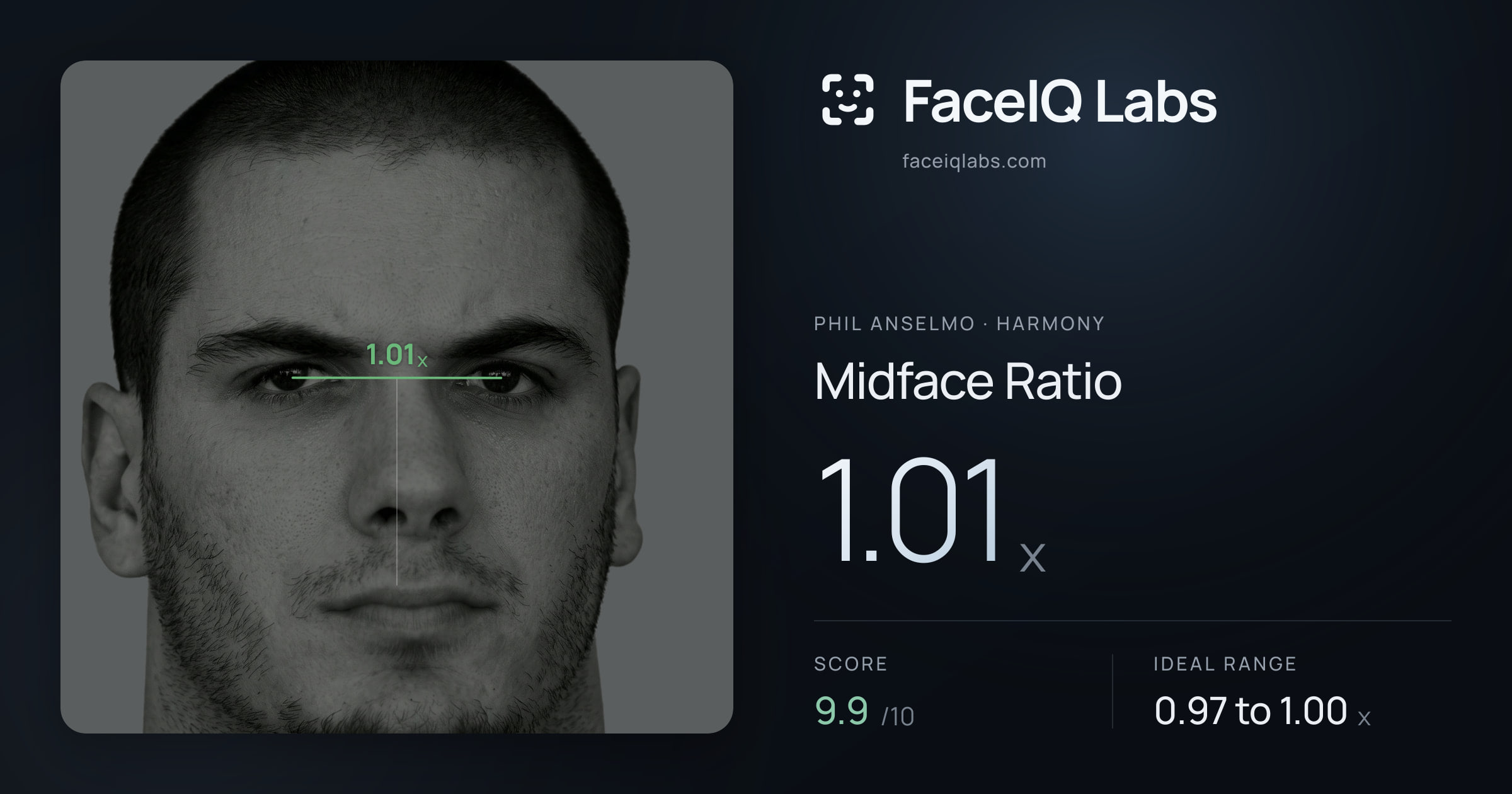 Phil Anselmo Midface Ratio: 1.01x, drawn on the photo