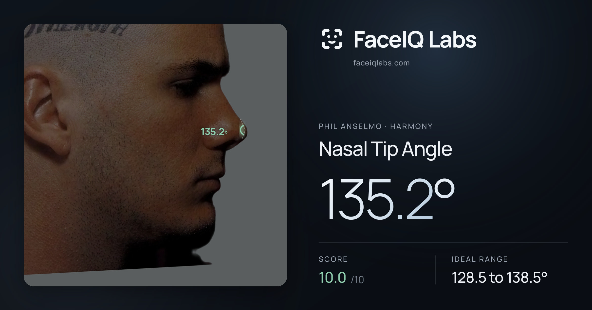 Phil Anselmo Nasal Tip Angle: 135.2°, drawn on the photo