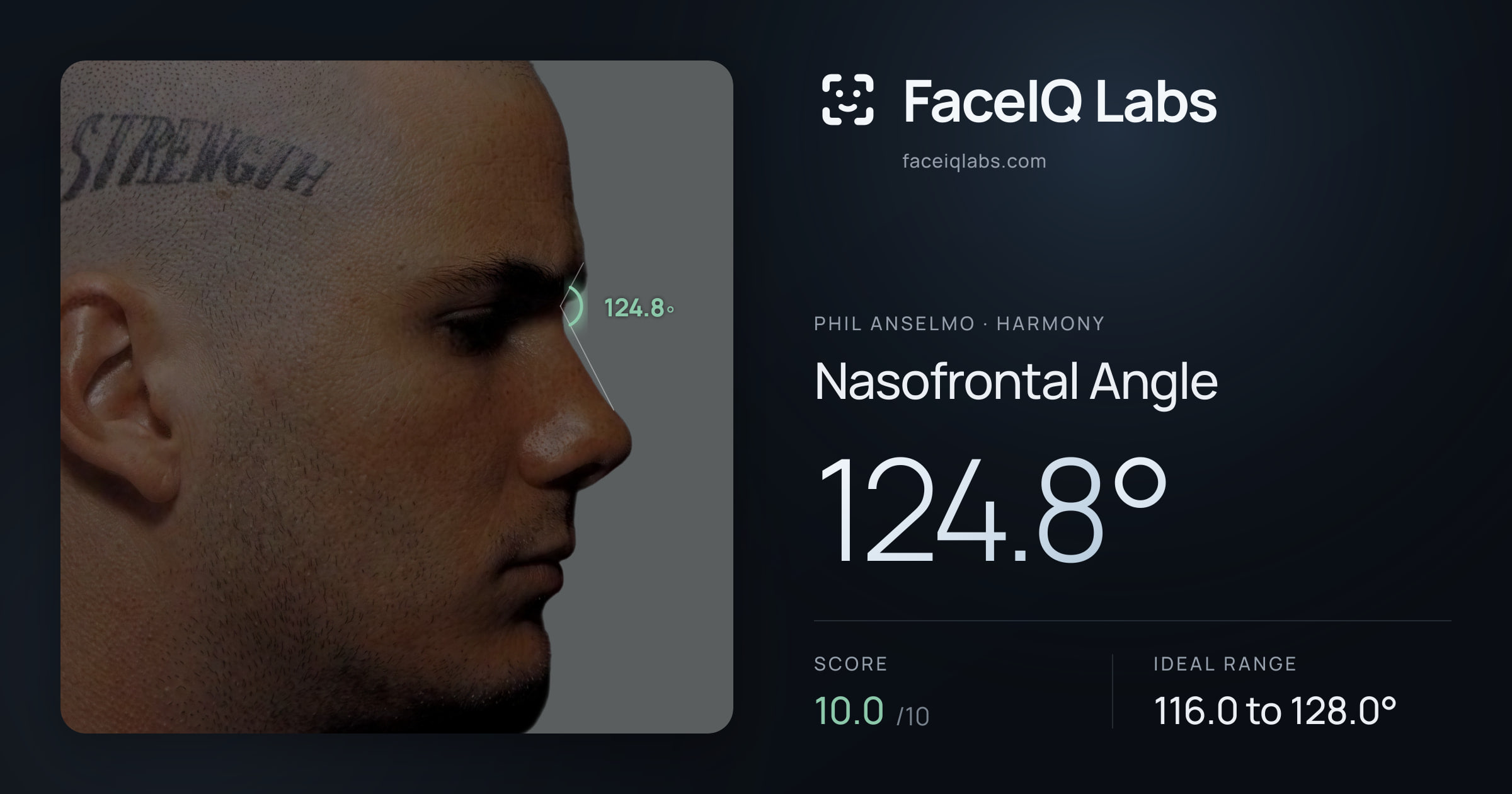 Phil Anselmo Nasofrontal Angle: 124.8°, drawn on the photo