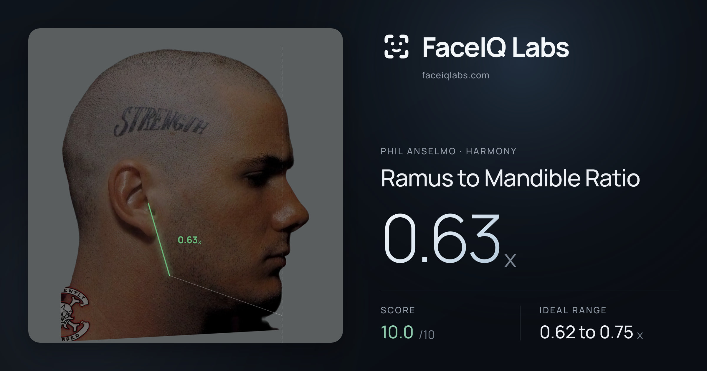 Phil Anselmo Ramus to Mandible Ratio: 0.63x, drawn on the photo