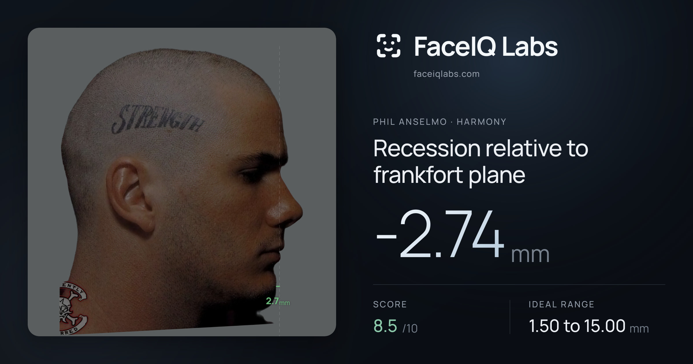 Phil Anselmo Recession relative to frankfort plane: -2.74mm, drawn on the photo