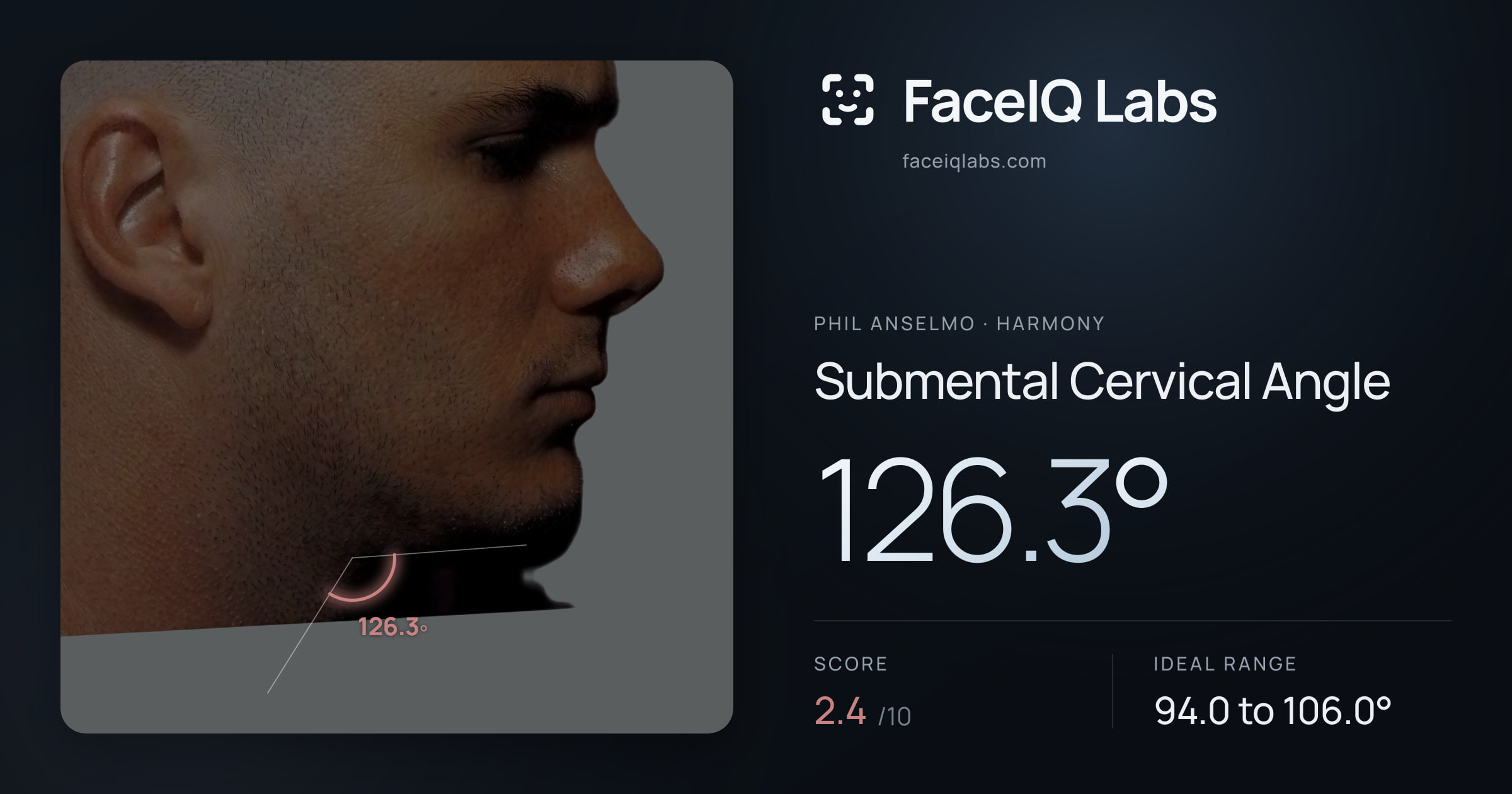 Phil Anselmo Submental Cervical Angle: 126.3°, drawn on the photo