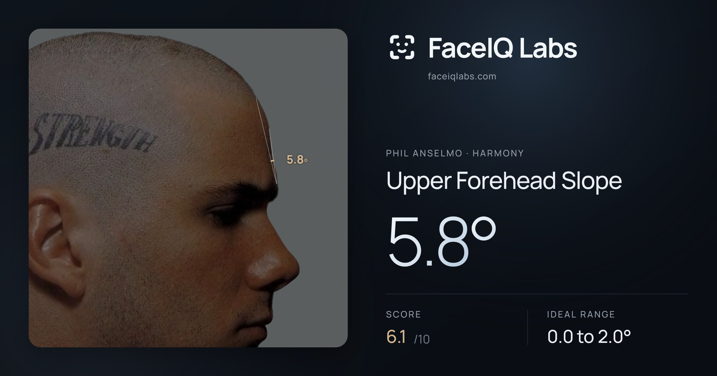 Phil Anselmo Upper Forehead Slope: 5.8°, drawn on the photo