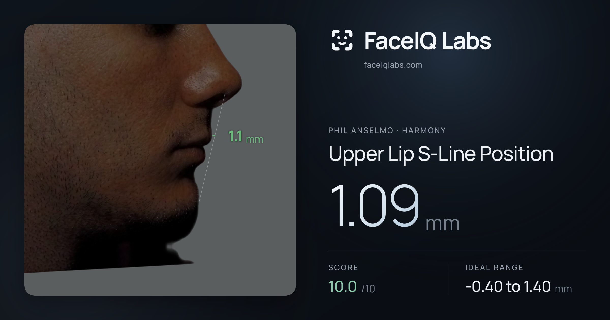 Phil Anselmo Upper Lip S-Line Position: 1.09mm, drawn on the photo