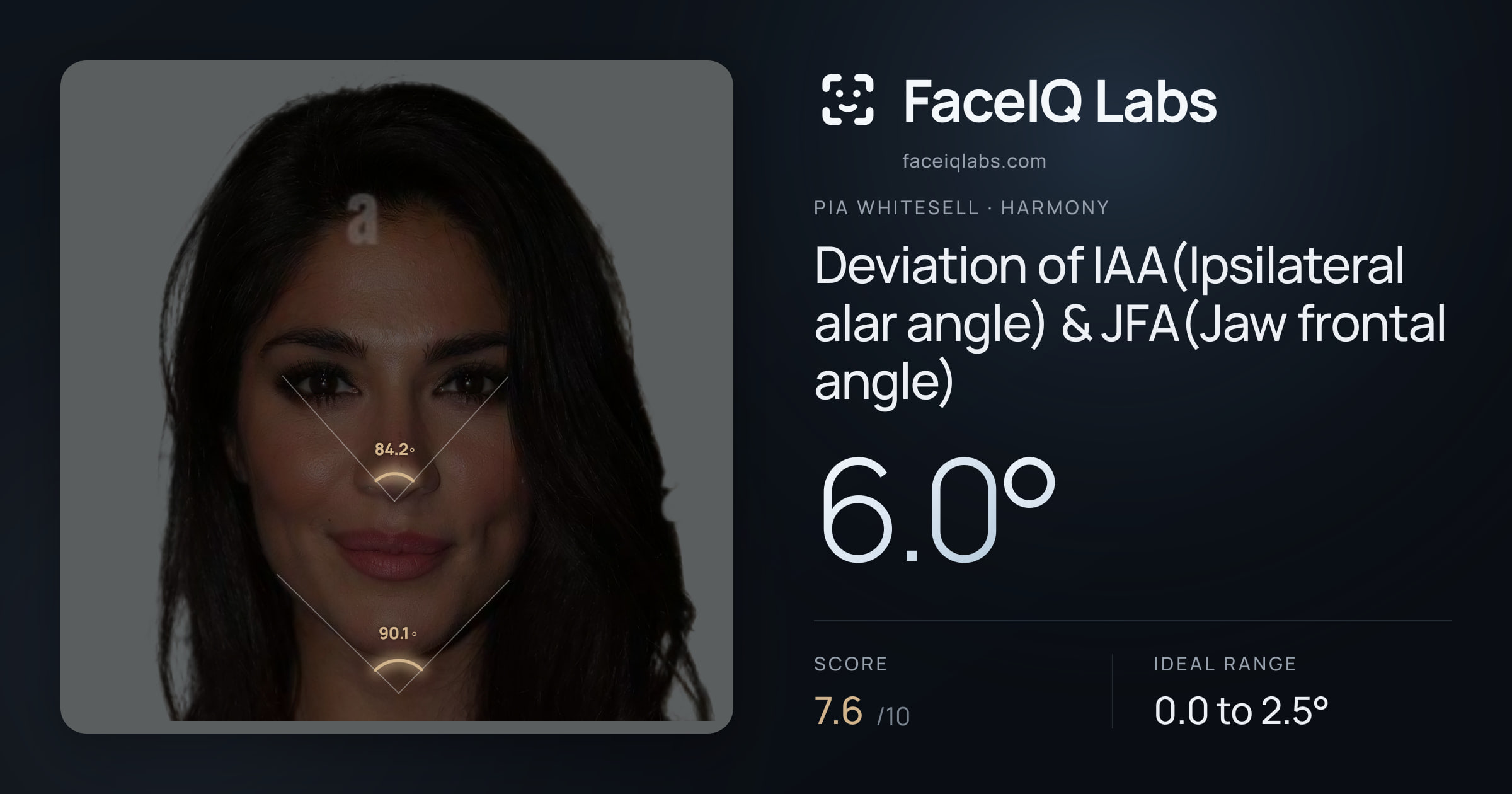 Pia Whitesell Deviation of IAA(Ipsilateral alar angle) & JFA(Jaw frontal angle): 6.0°, drawn on the photo