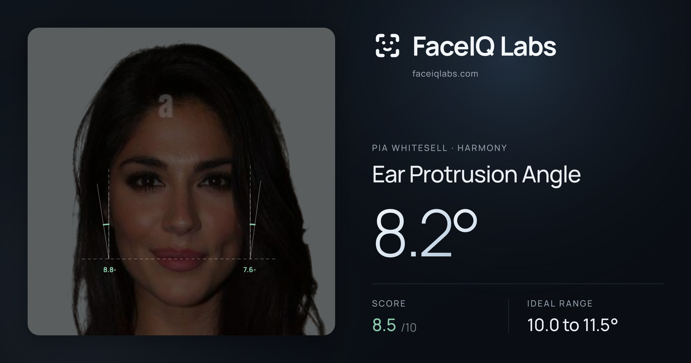 Pia Whitesell Ear Protrusion Angle: 8.2°, drawn on the photo