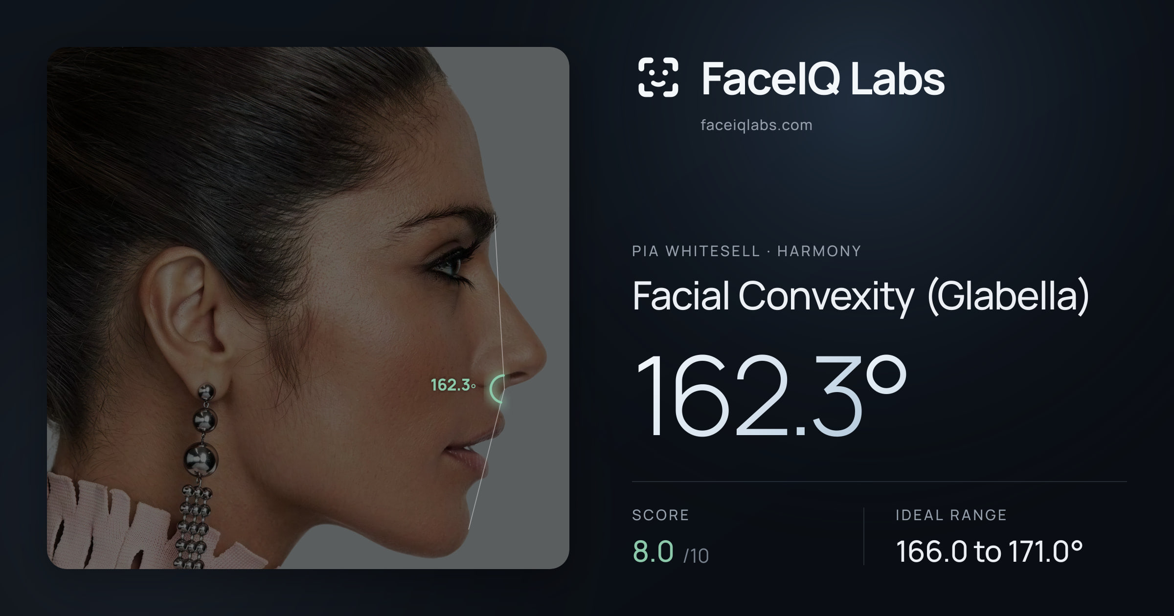 Pia Whitesell Facial Convexity (Glabella): 162.3°, drawn on the photo