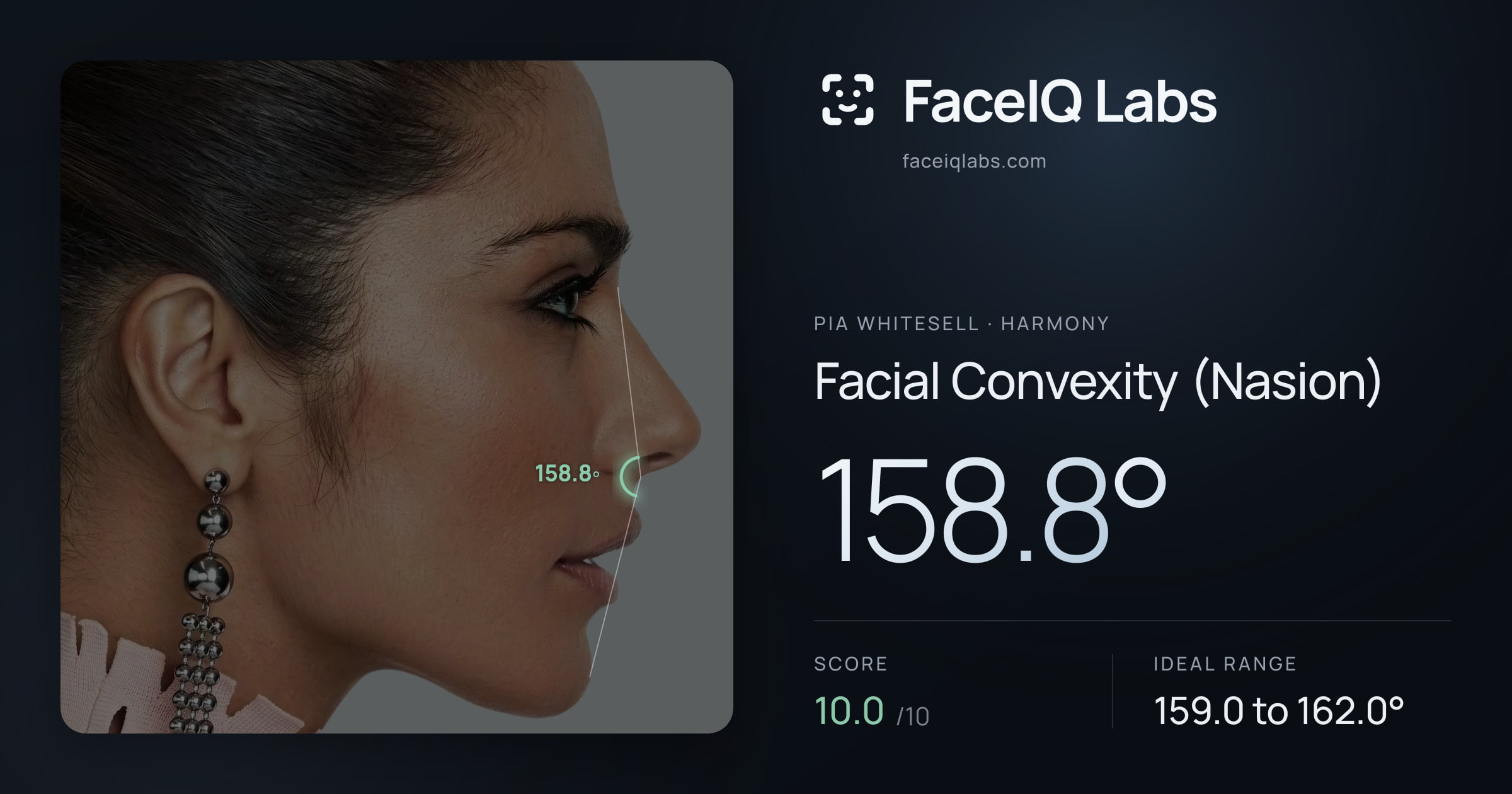 Pia Whitesell Facial Convexity (Nasion): 158.8°, drawn on the photo