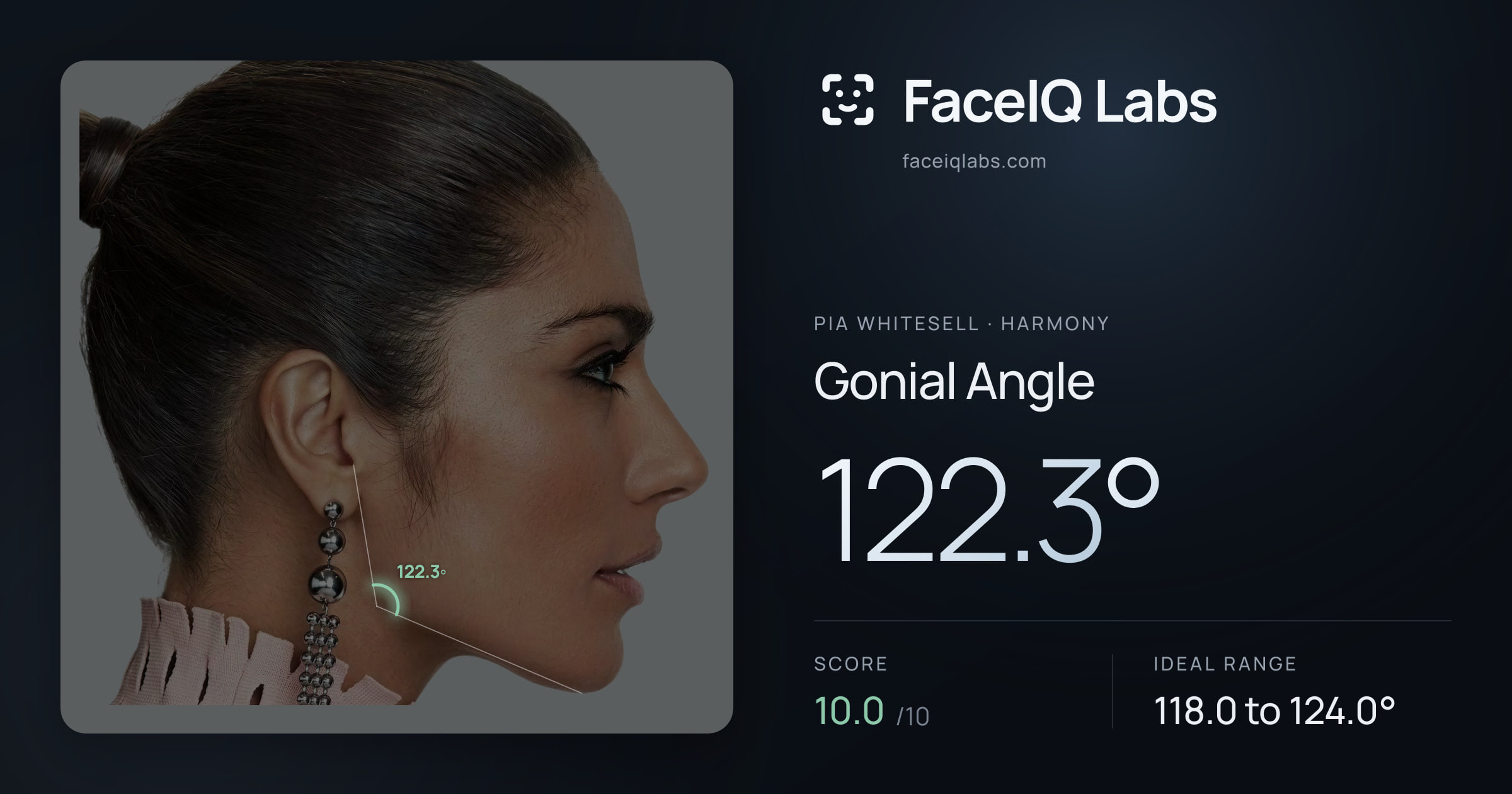 Pia Whitesell Gonial Angle: 122.3°, drawn on the photo