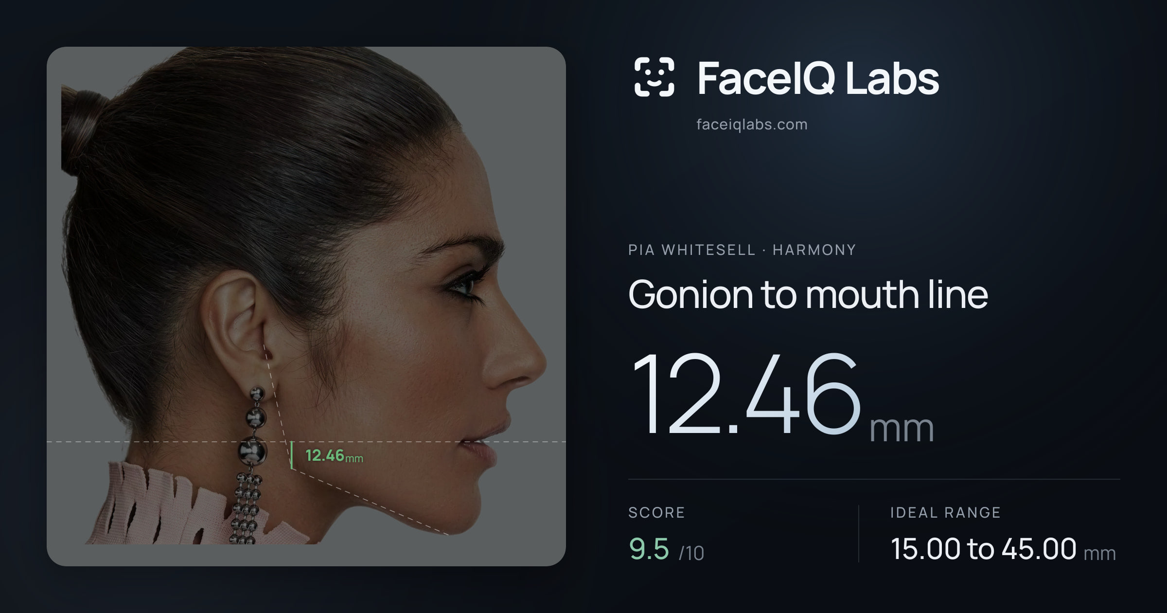 Pia Whitesell Gonion to mouth line: 12.46mm, drawn on the photo