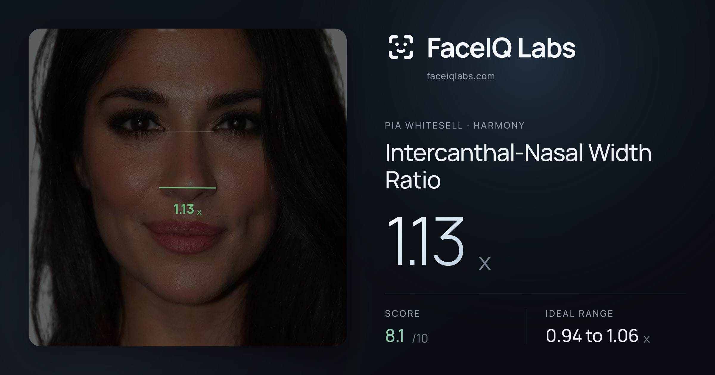 Pia Whitesell Intercanthal-Nasal Width Ratio: 1.13x, drawn on the photo