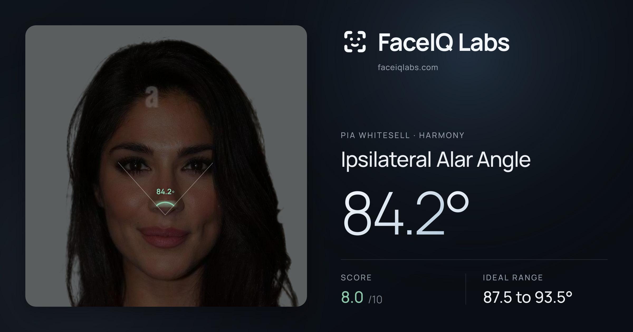 Pia Whitesell Ipsilateral Alar Angle: 84.2°, drawn on the photo