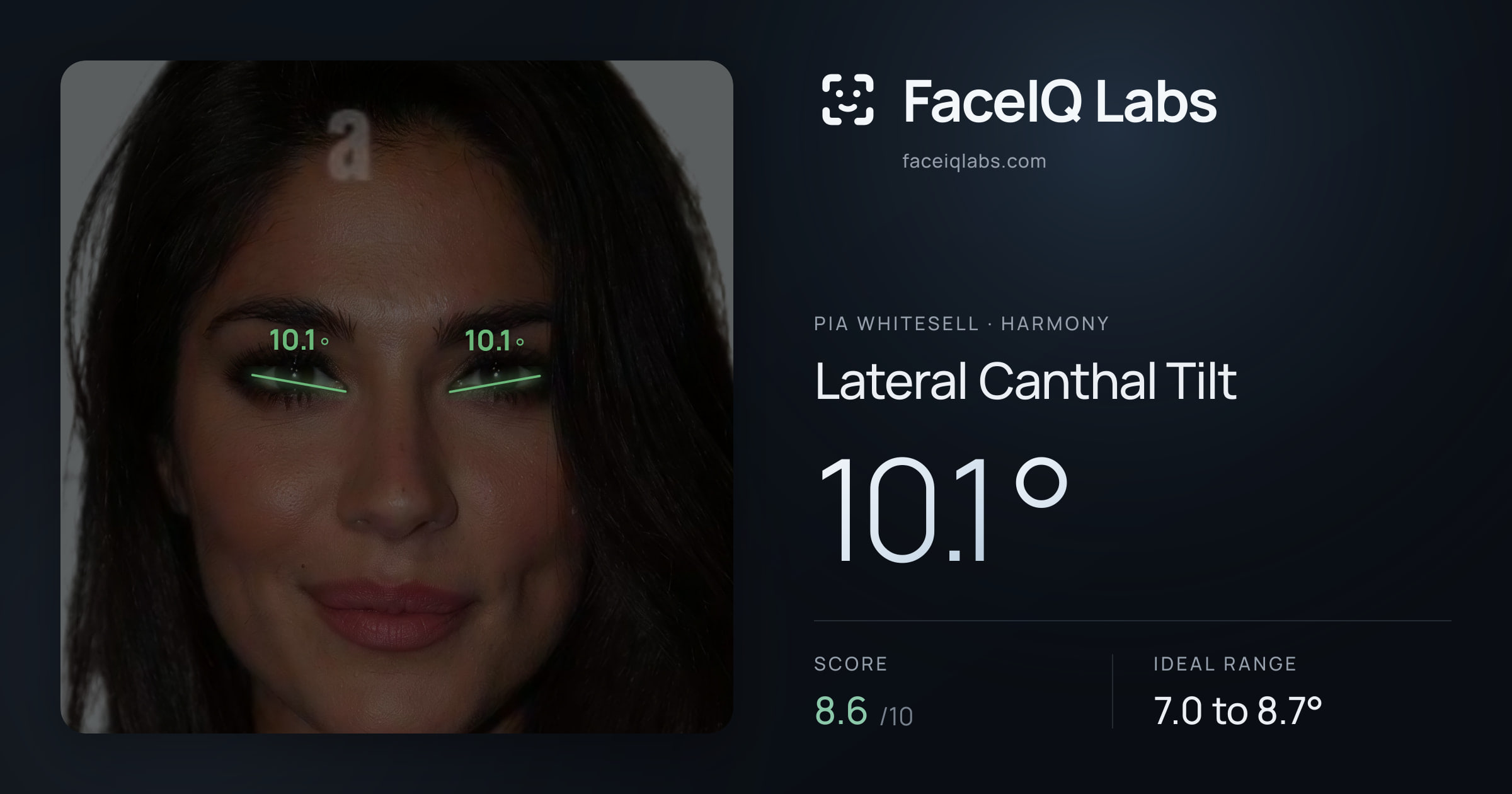 Pia Whitesell Lateral Canthal Tilt: 10.1°, drawn on the photo