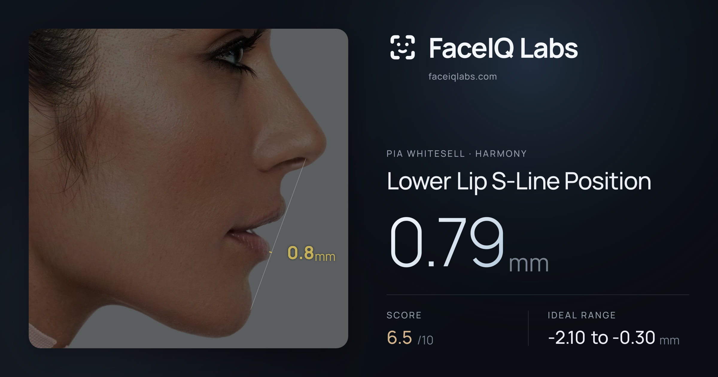 Pia Whitesell Lower Lip S-Line Position: 0.79mm, drawn on the photo