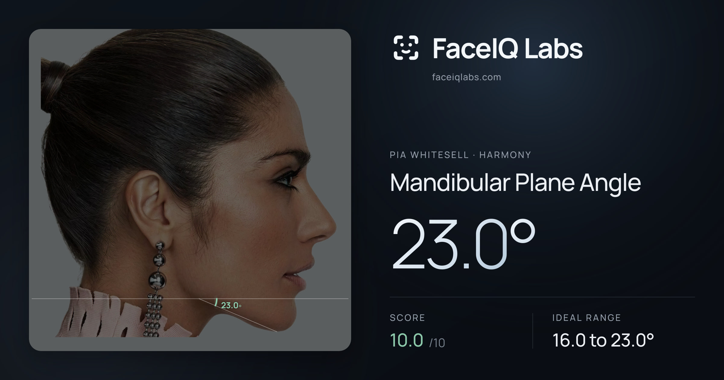 Pia Whitesell Mandibular Plane Angle: 23.0°, drawn on the photo