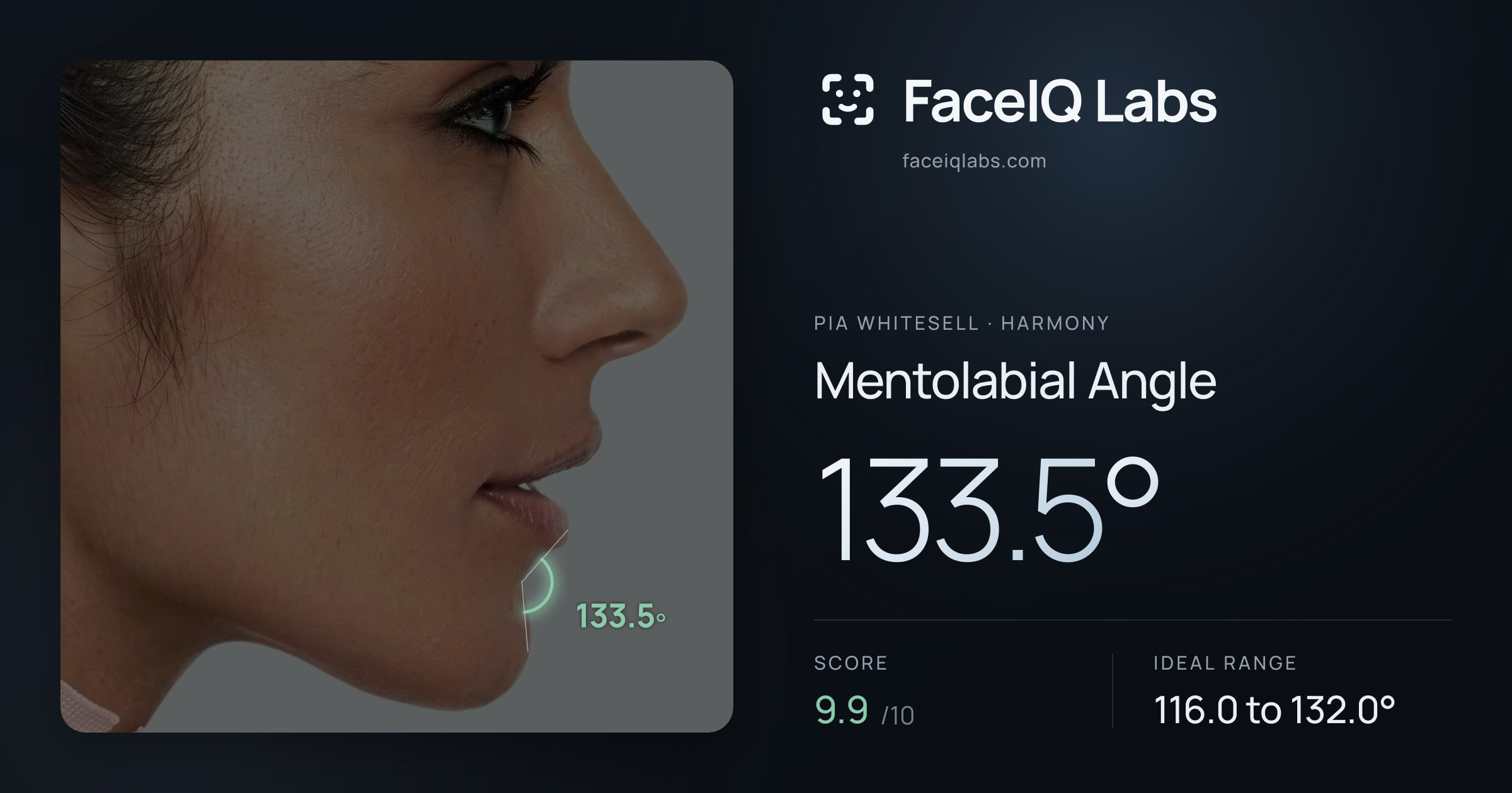Pia Whitesell Mentolabial Angle: 133.5°, drawn on the photo