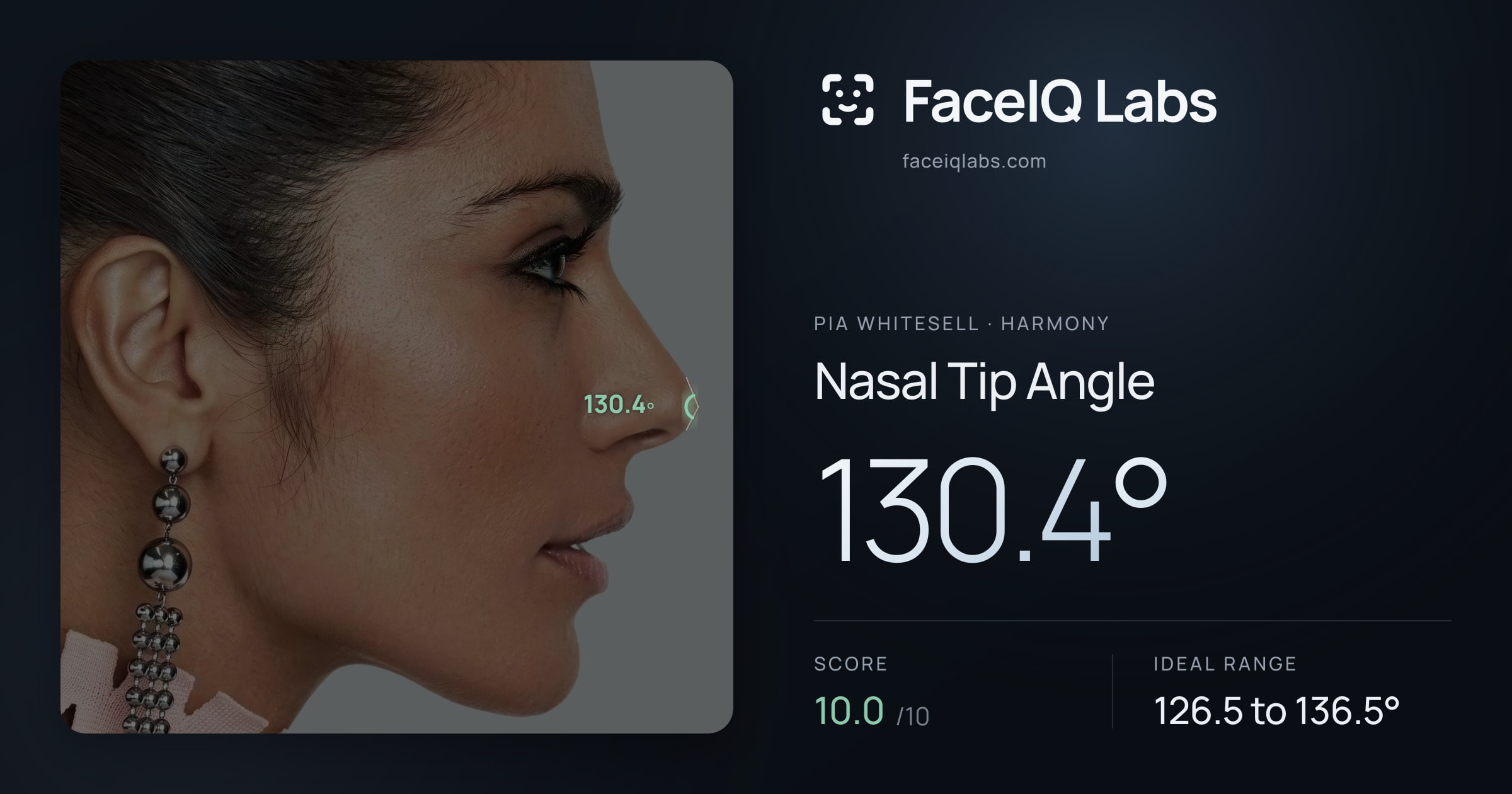 Pia Whitesell Nasal Tip Angle: 130.4°, drawn on the photo
