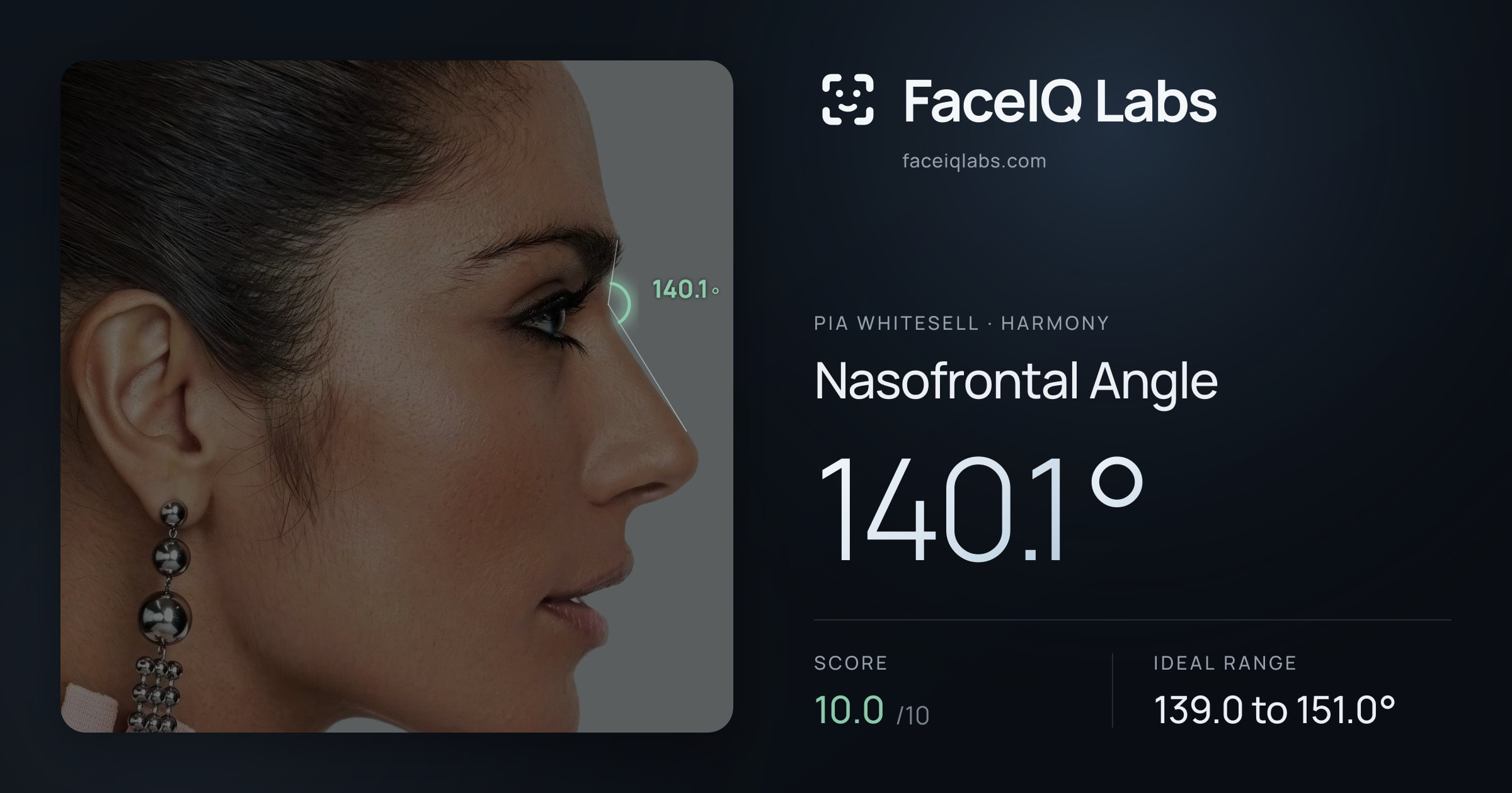 Pia Whitesell Nasofrontal Angle: 140.1°, drawn on the photo