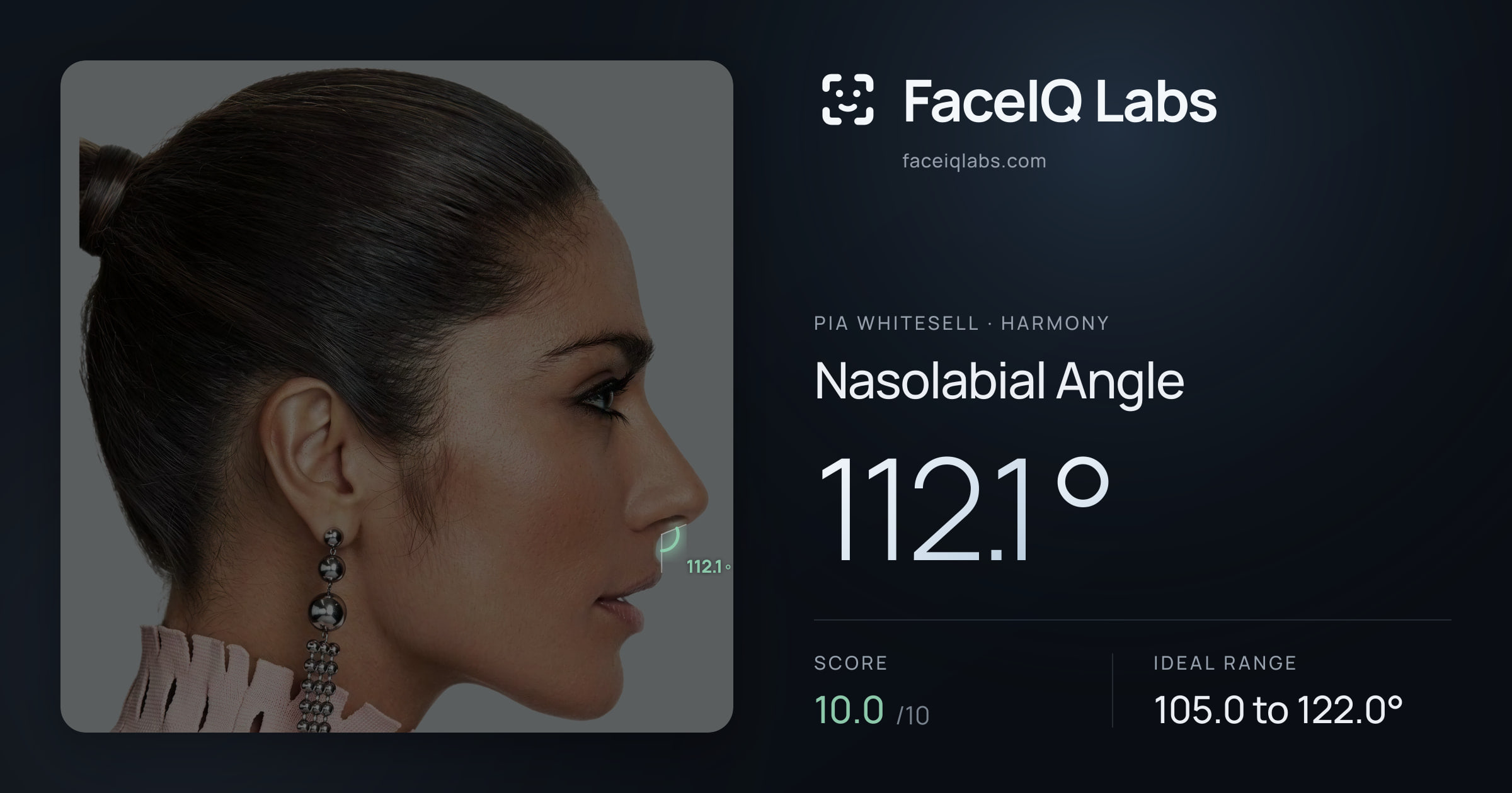 Pia Whitesell Nasolabial Angle: 112.1°, drawn on the photo