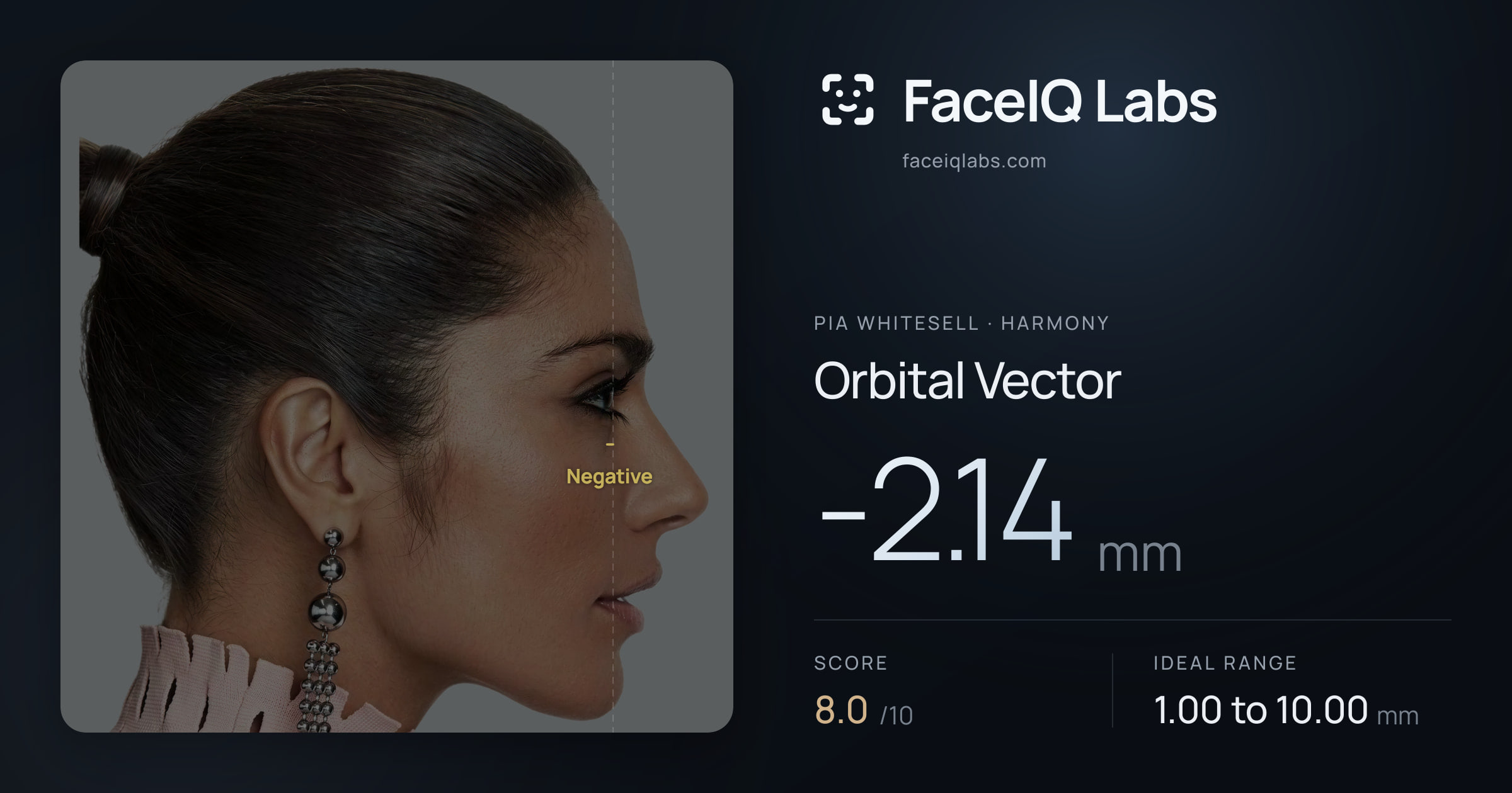 Pia Whitesell Orbital Vector: -2.14mm, drawn on the photo