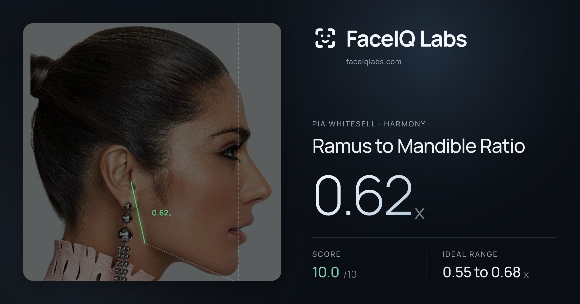 Pia Whitesell Ramus to Mandible Ratio: 0.62x, drawn on the photo