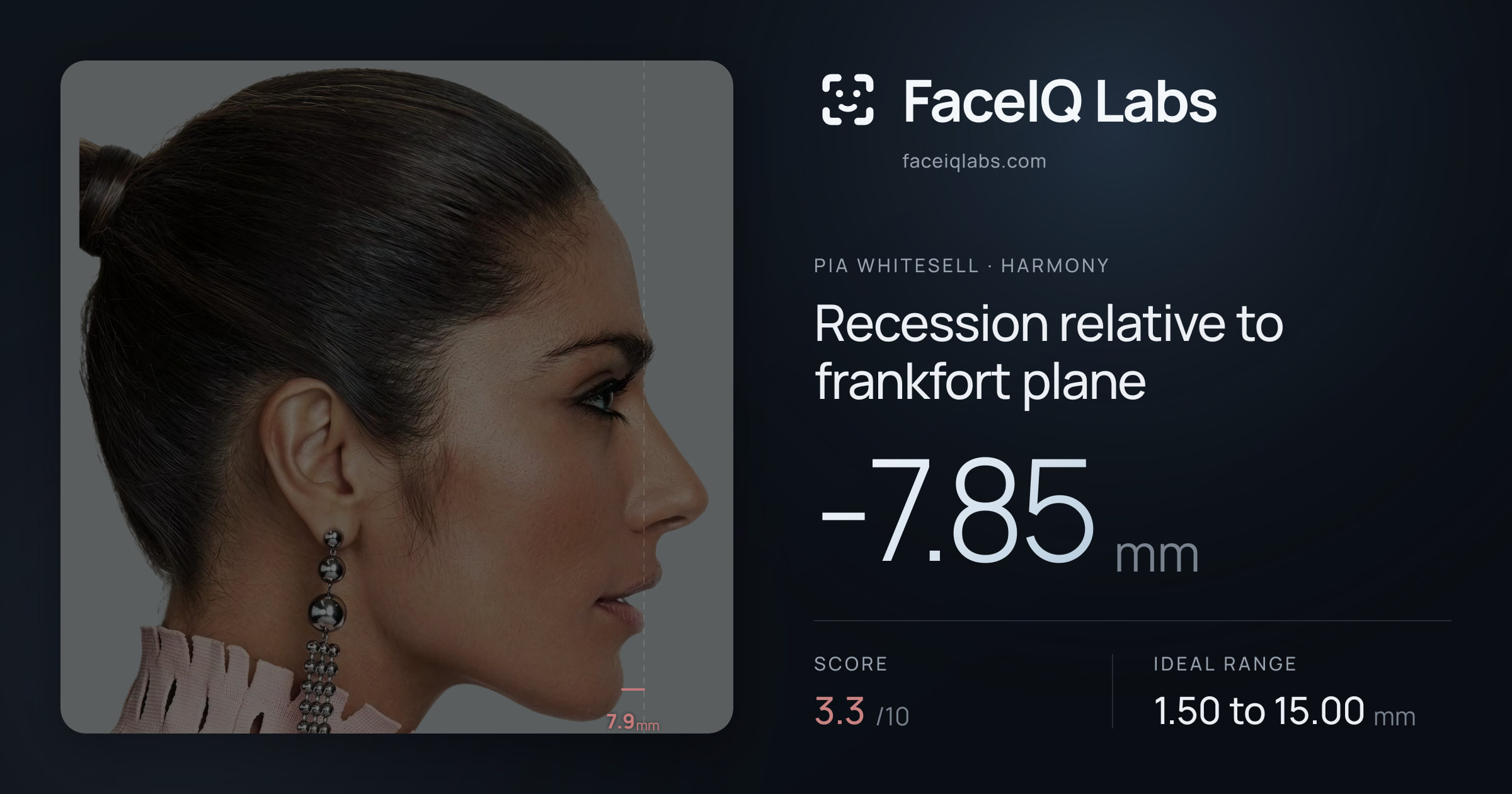 Pia Whitesell Recession relative to frankfort plane: -7.85mm, drawn on the photo
