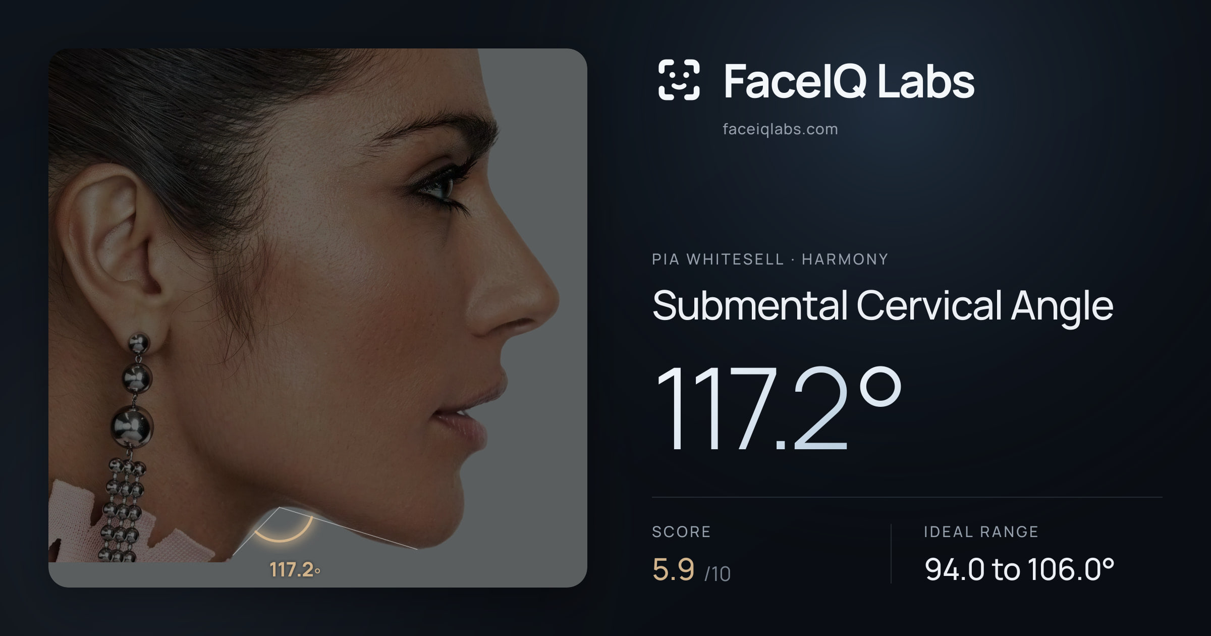 Pia Whitesell Submental Cervical Angle: 117.2°, drawn on the photo