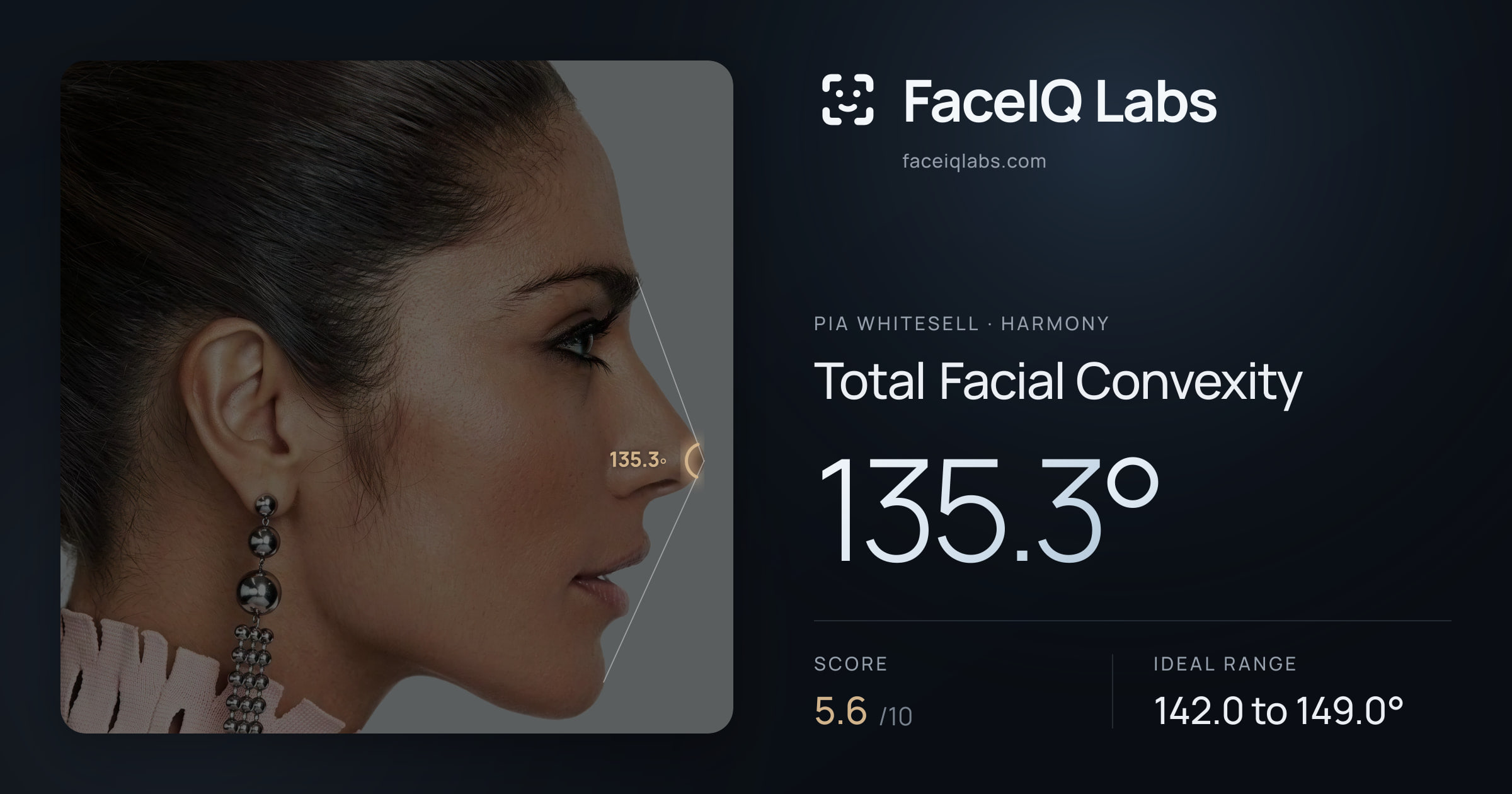 Pia Whitesell Total Facial Convexity: 135.3°, drawn on the photo