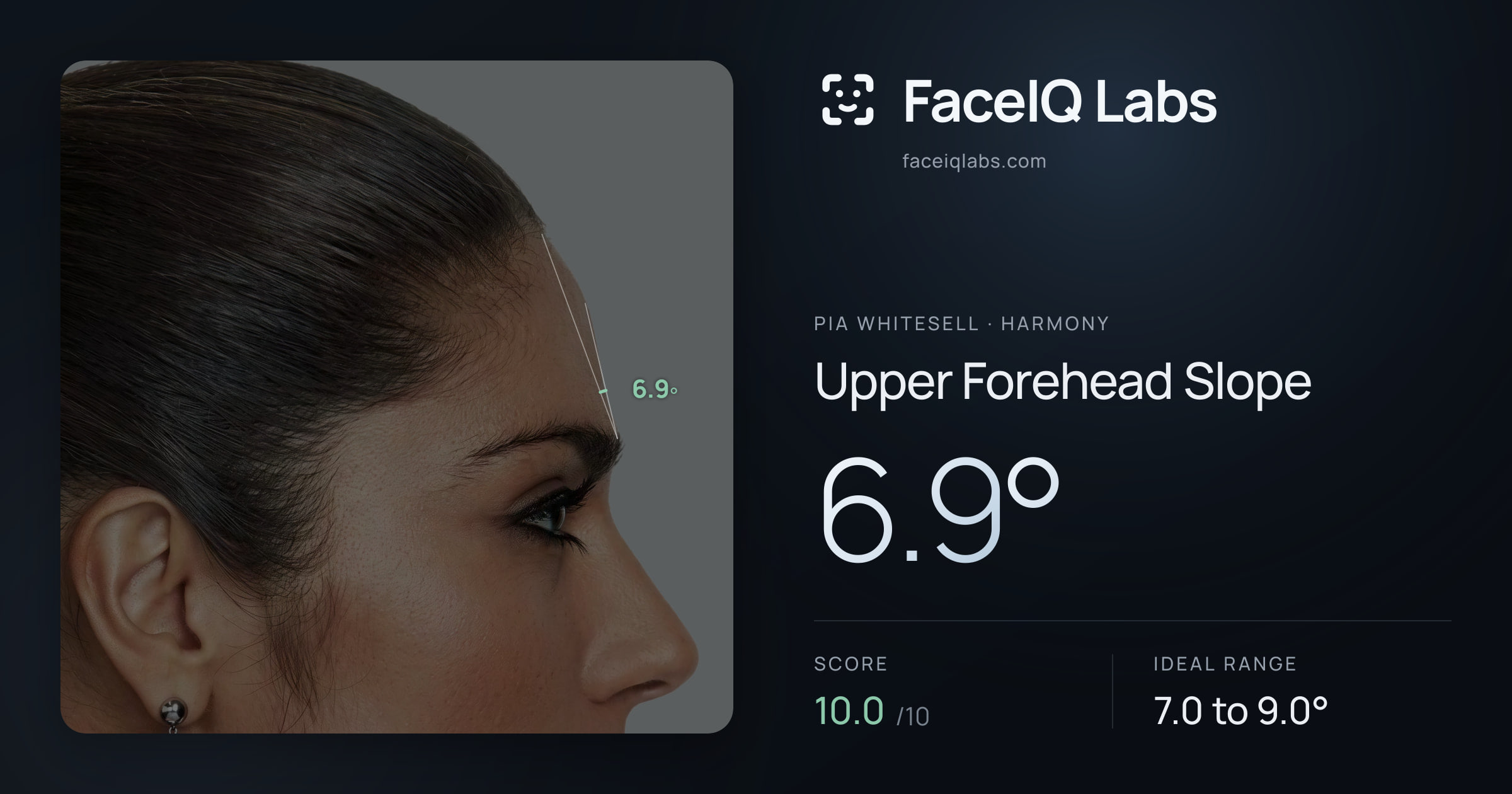 Pia Whitesell Upper Forehead Slope: 6.9°, drawn on the photo